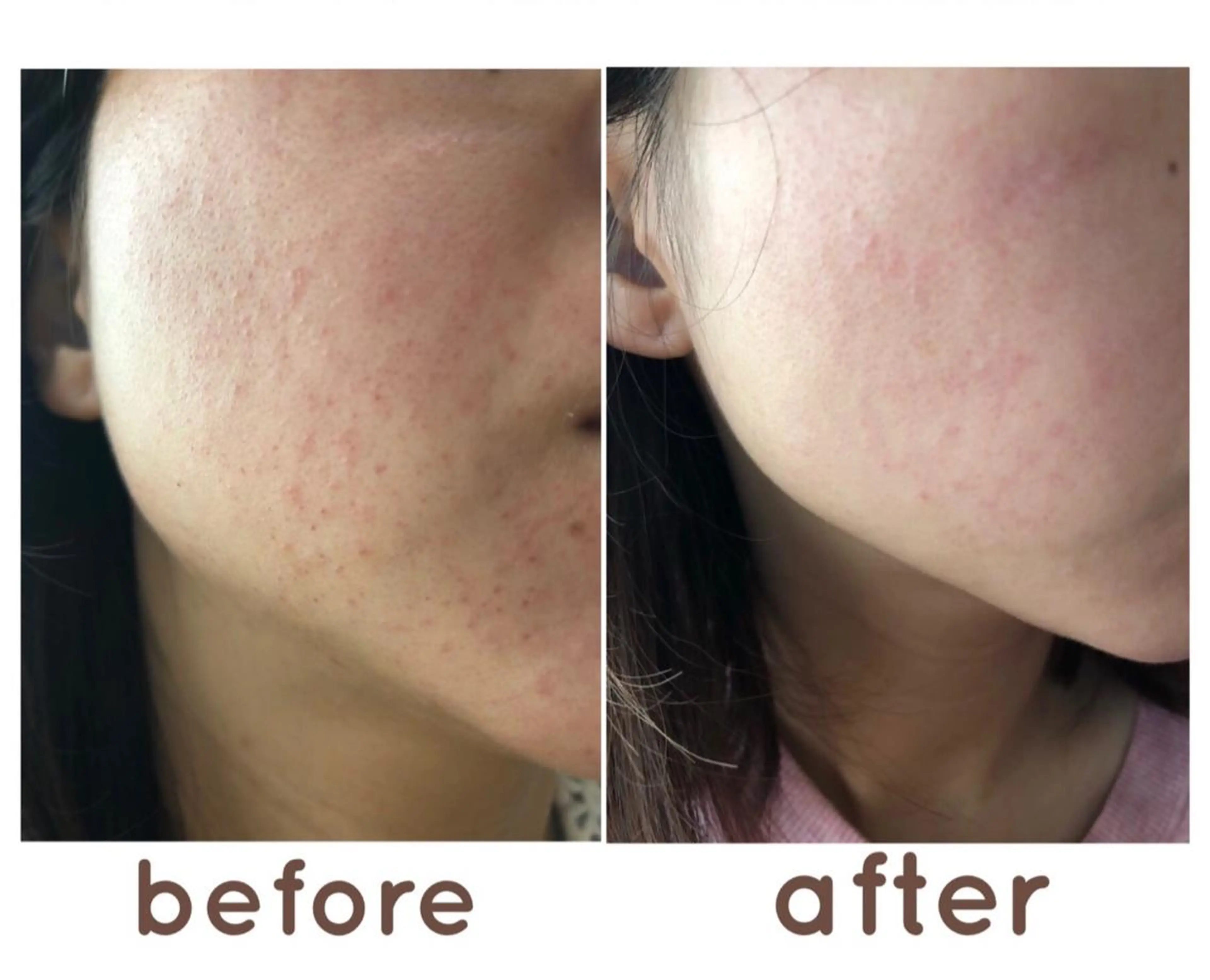 エステ 美肌サロン Lei-lani💖のエステ・リラクイメージ