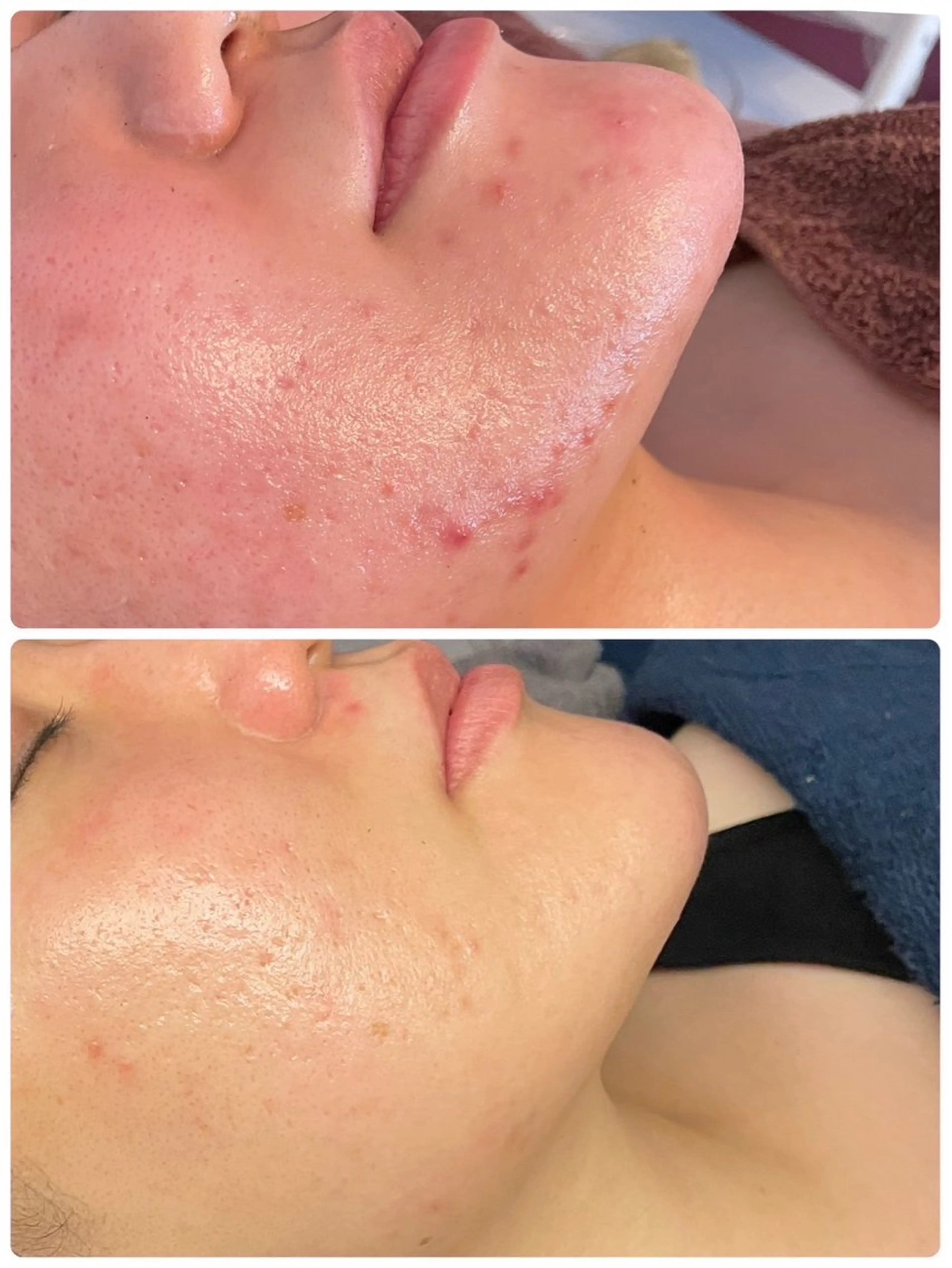 エステ Lei beauty salon所属・松ヤニワックス専門/ 梅田/Leiのエステ・リラクイメージ