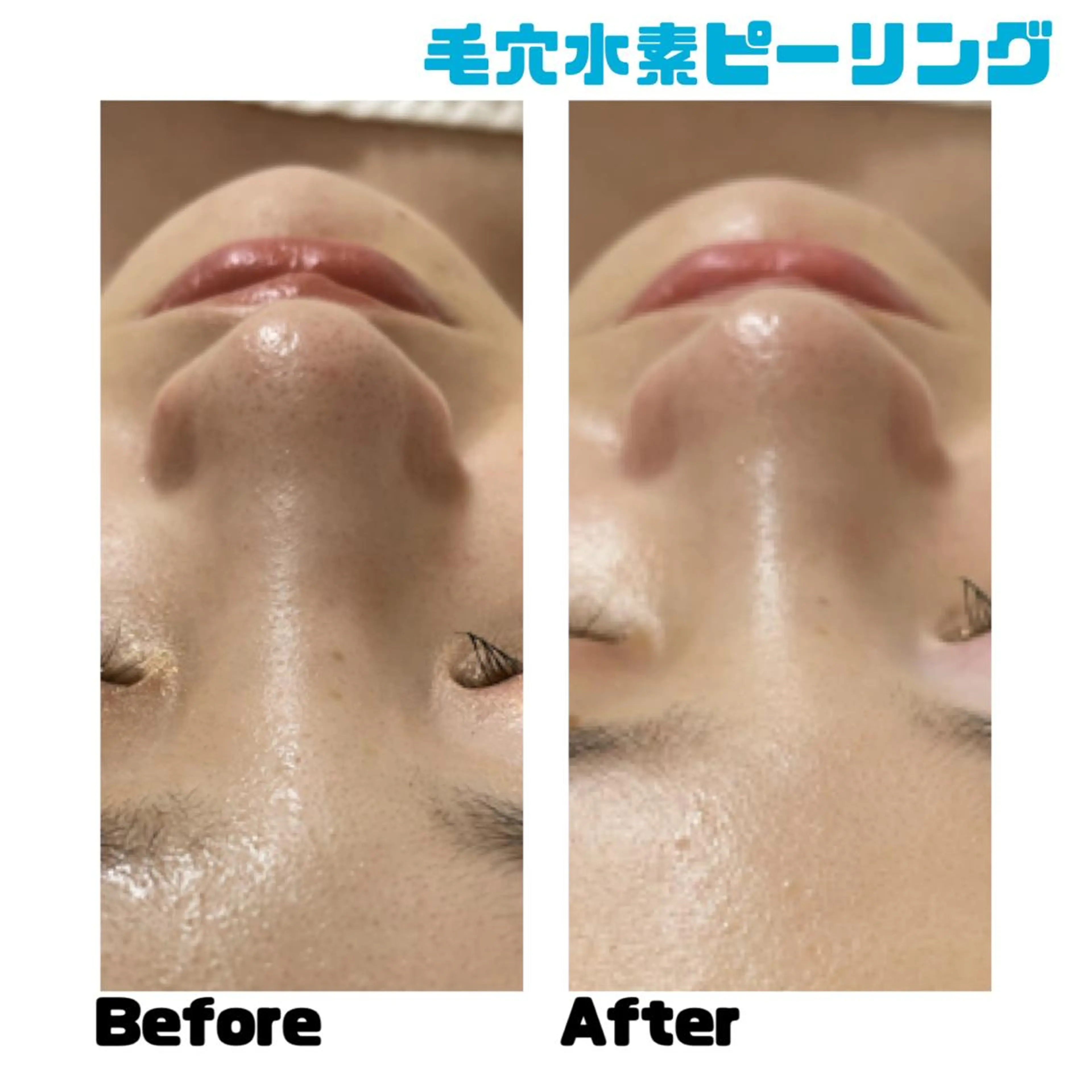 エステ プライベートサロンmoyo所属・プライベートサロン moyoのエステ・リラクイメージ