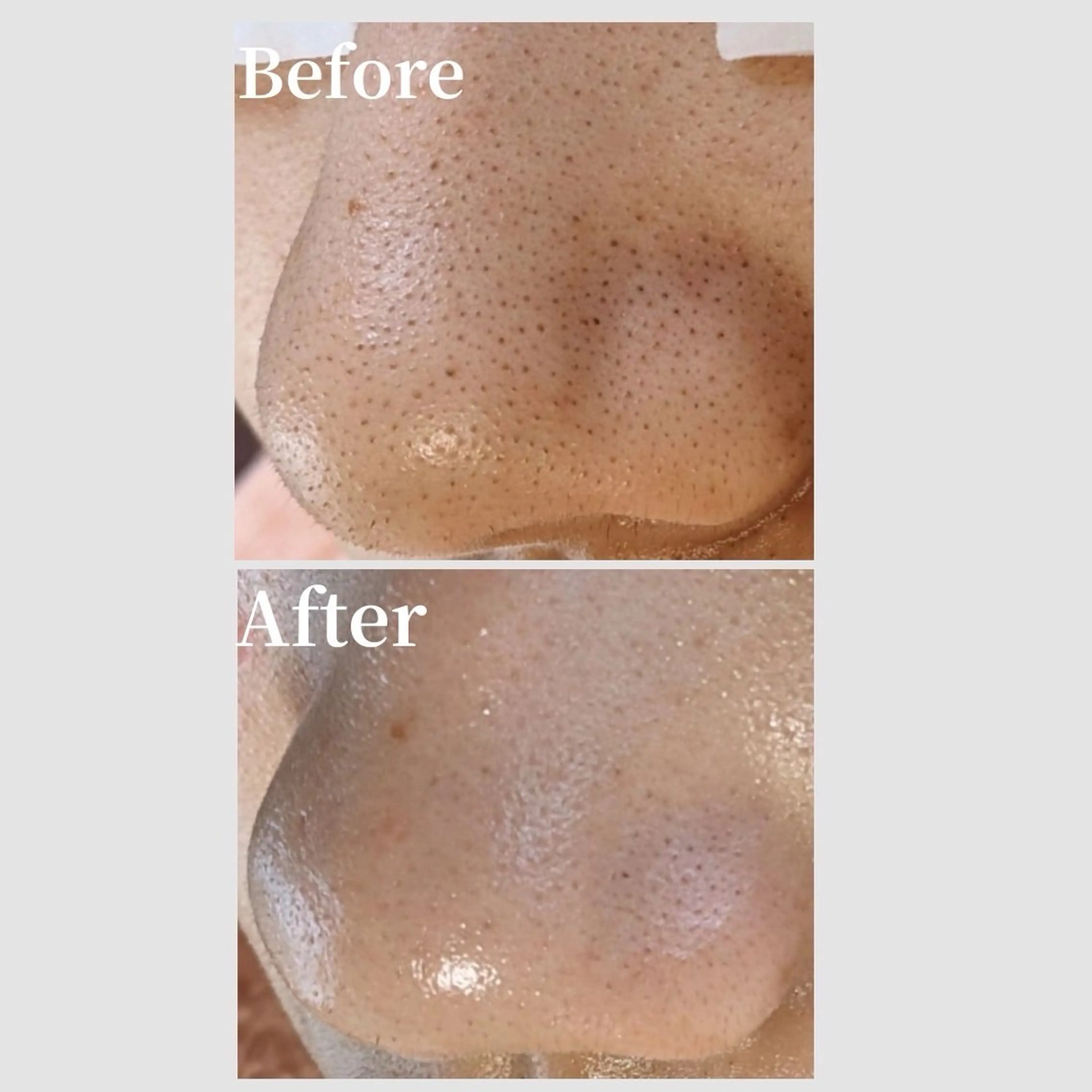 エステ リラク 韓国肌管理 【毛穴専科】のエステ・リラクイメージ