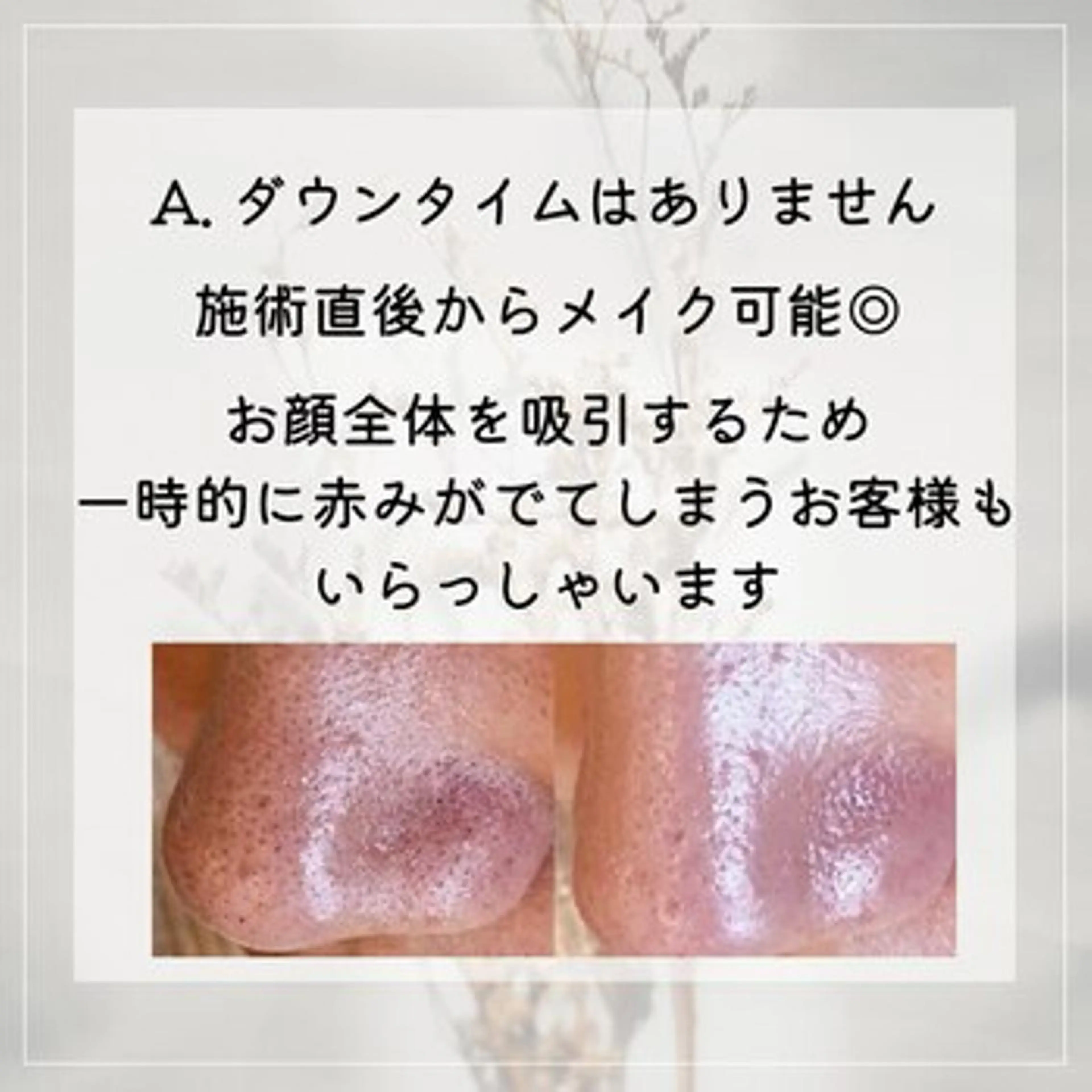 その他 Jessica 清水🎀✨のエステ・リラクイメージ