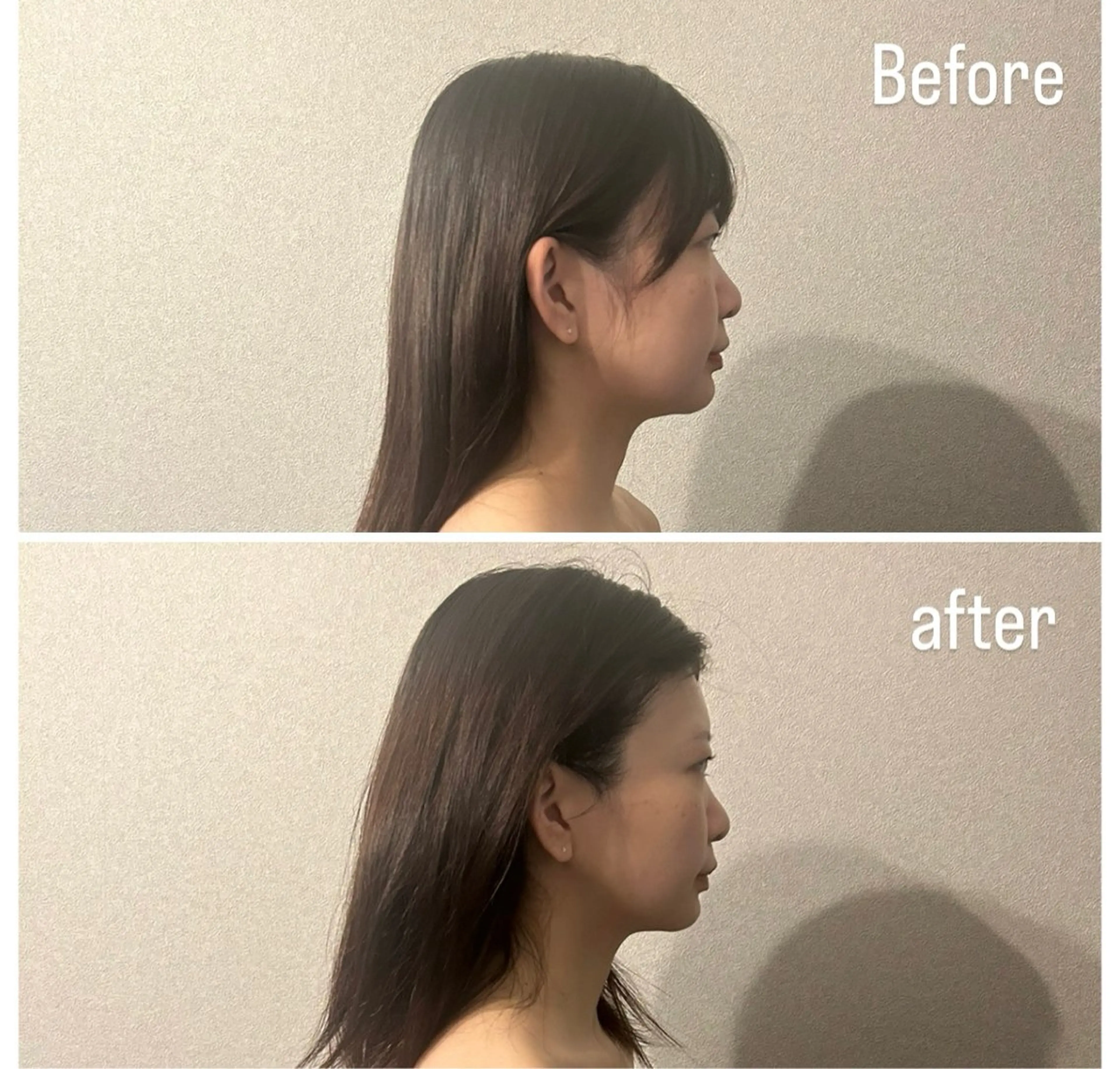 歴14年！劇的 小顔矯正Luanaのエステ・リラクイメージ