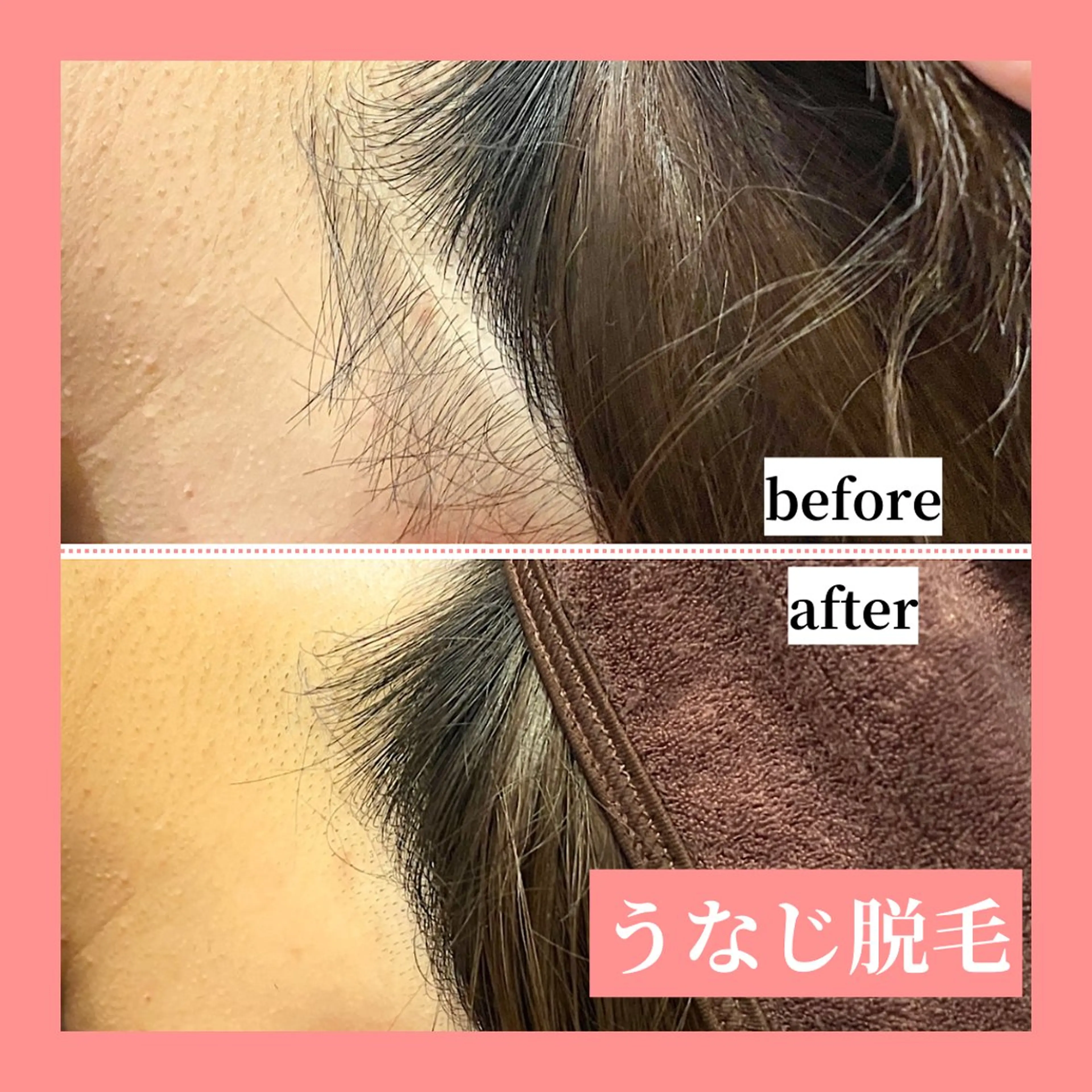 メンズ 脱毛 天神【効果重視脱毛】 YouMakeのエステ・リラクイメージ