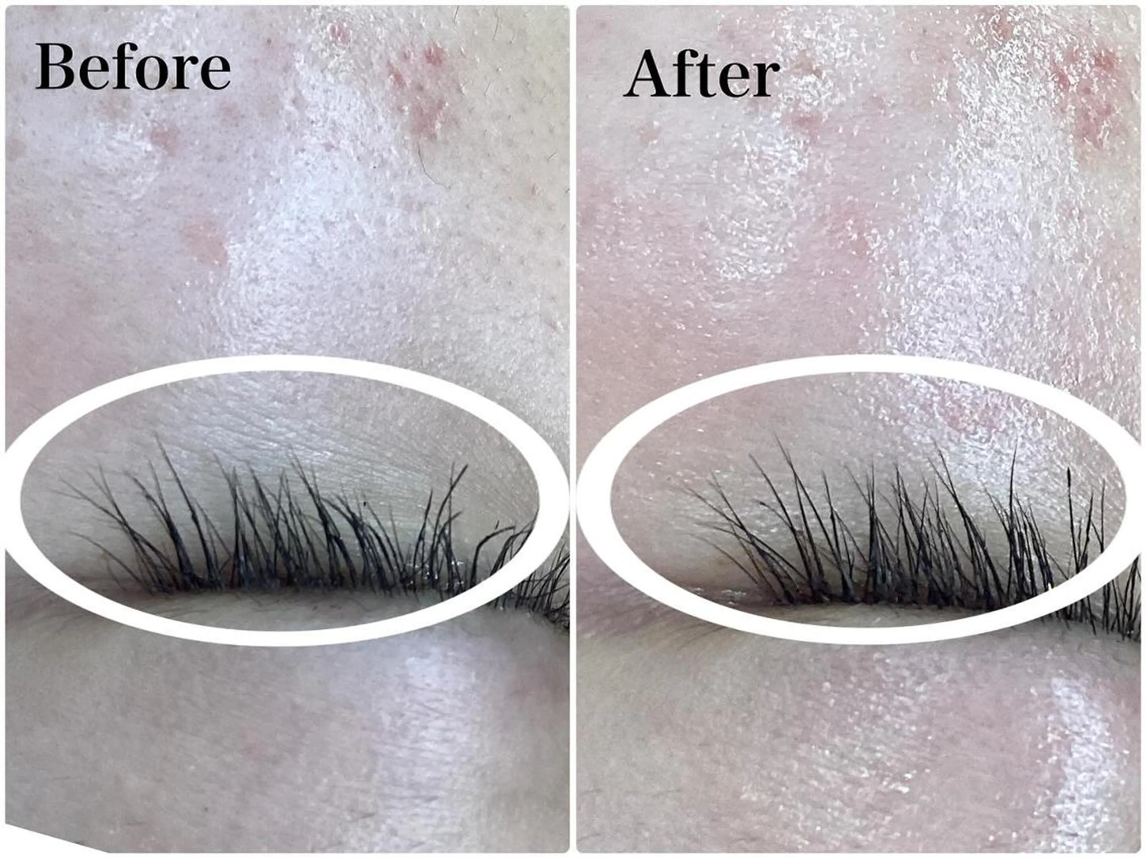 エステ パーソナルエステ L'purのエステ・リラクイメージ