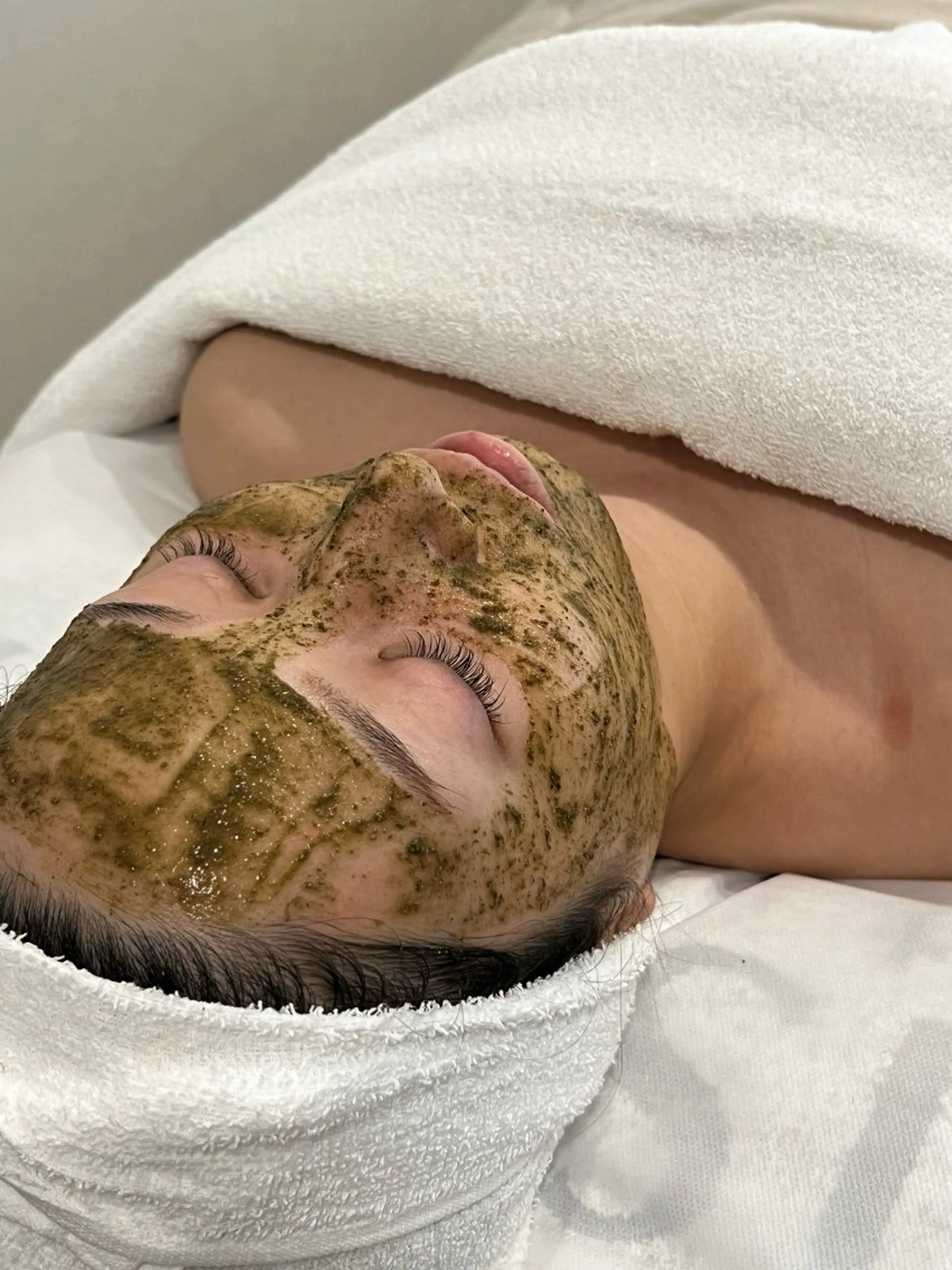 HAABREPRO 肌再生ハーブピーリング(クリスティーナのローブドメーラを使用しています)※DT有の写真