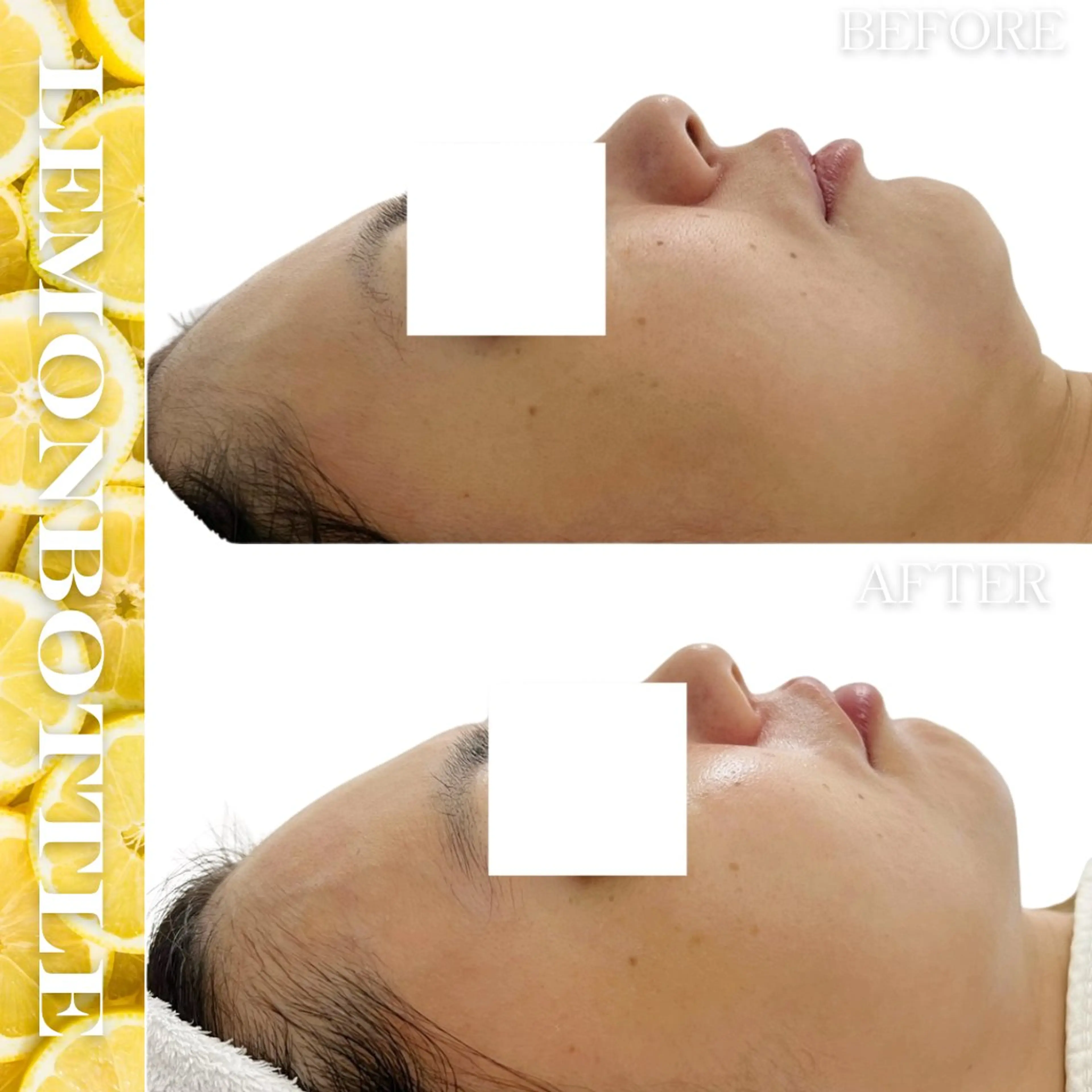 その他 Liam《美肌管理/ 3D小顔/脂肪ケア》のエステ・リラクイメージ