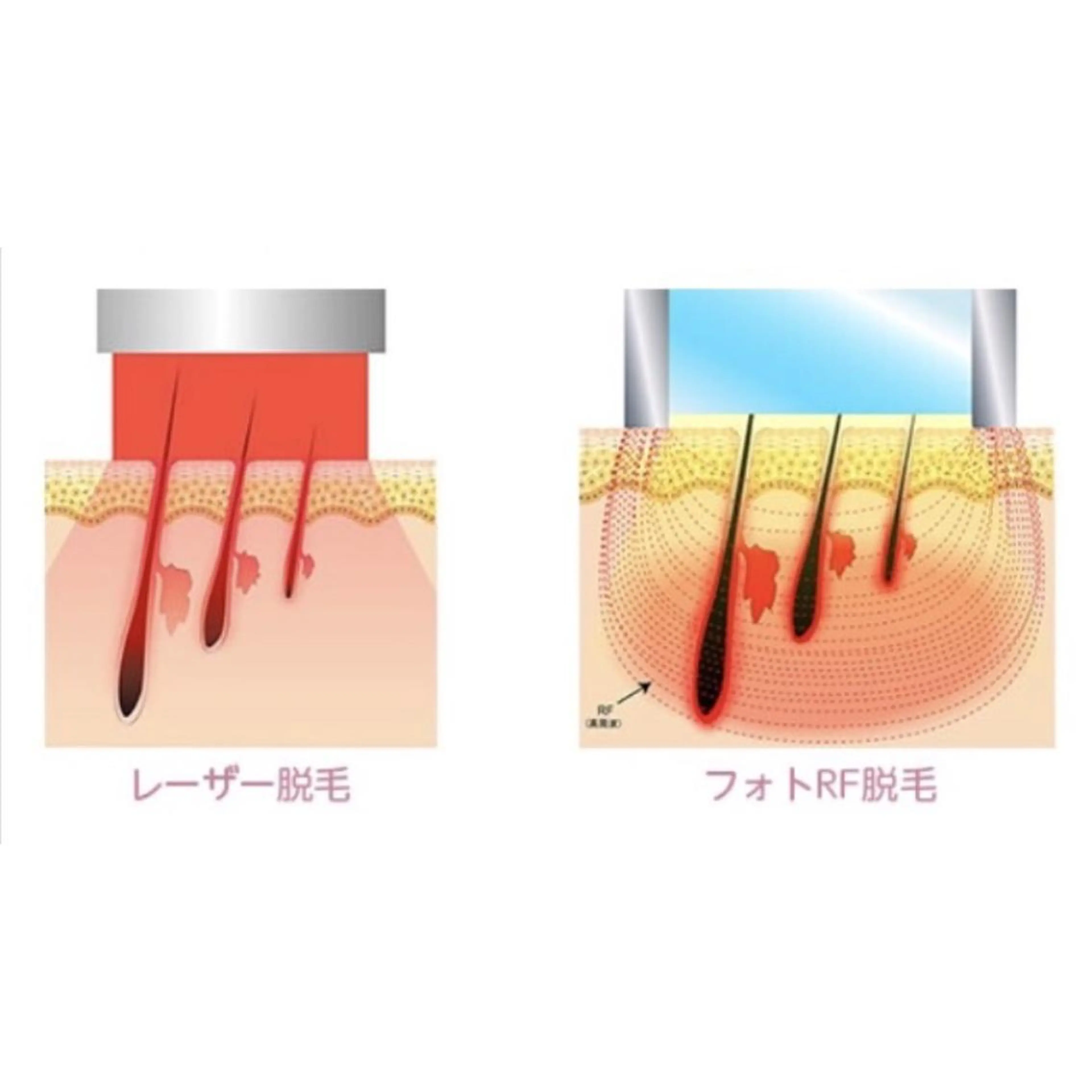 MiMiy 銀座店のエステ・リラクイメージ