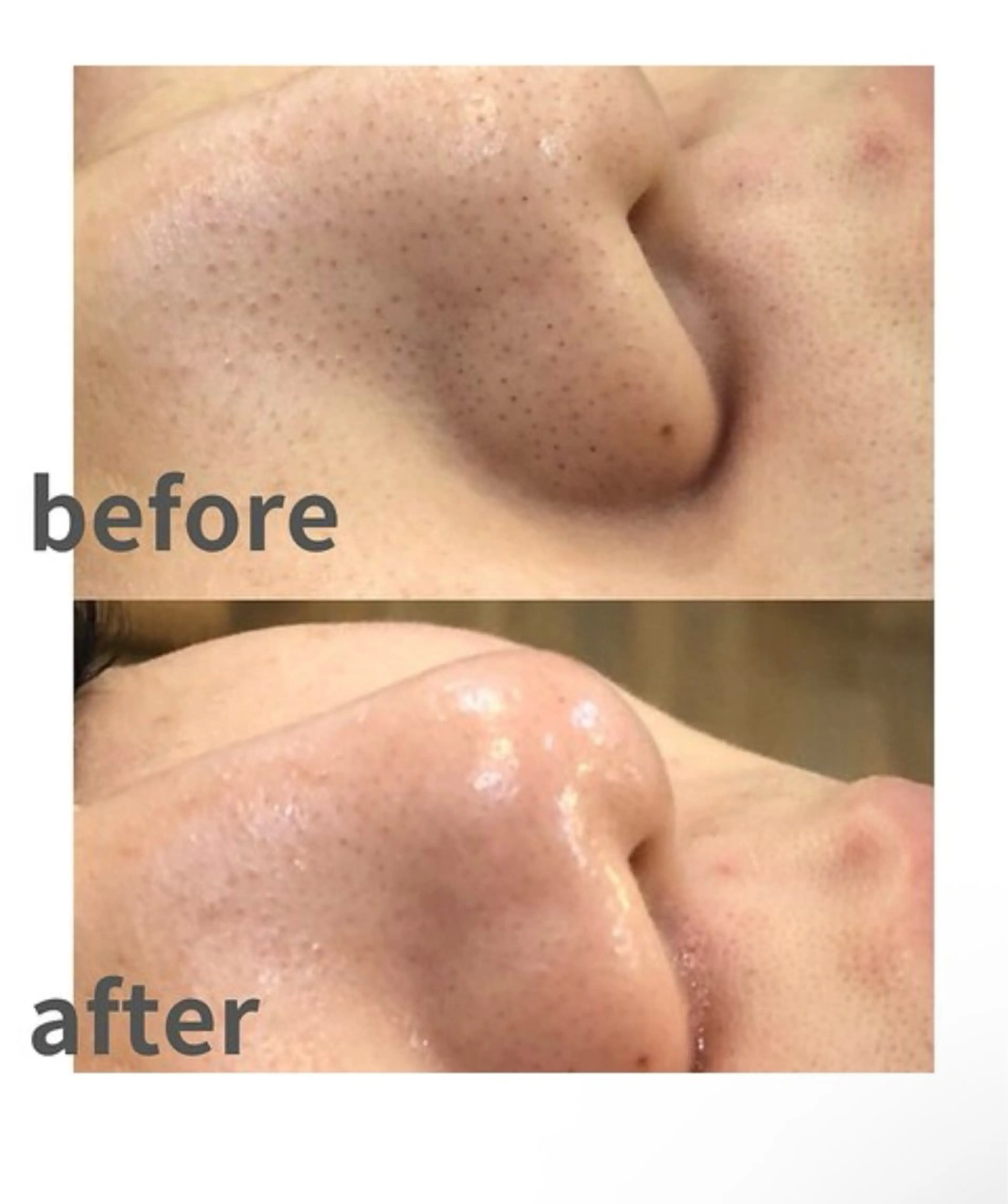 MINOA所属・MINOA 井上🌷のエステ・リラクイメージ