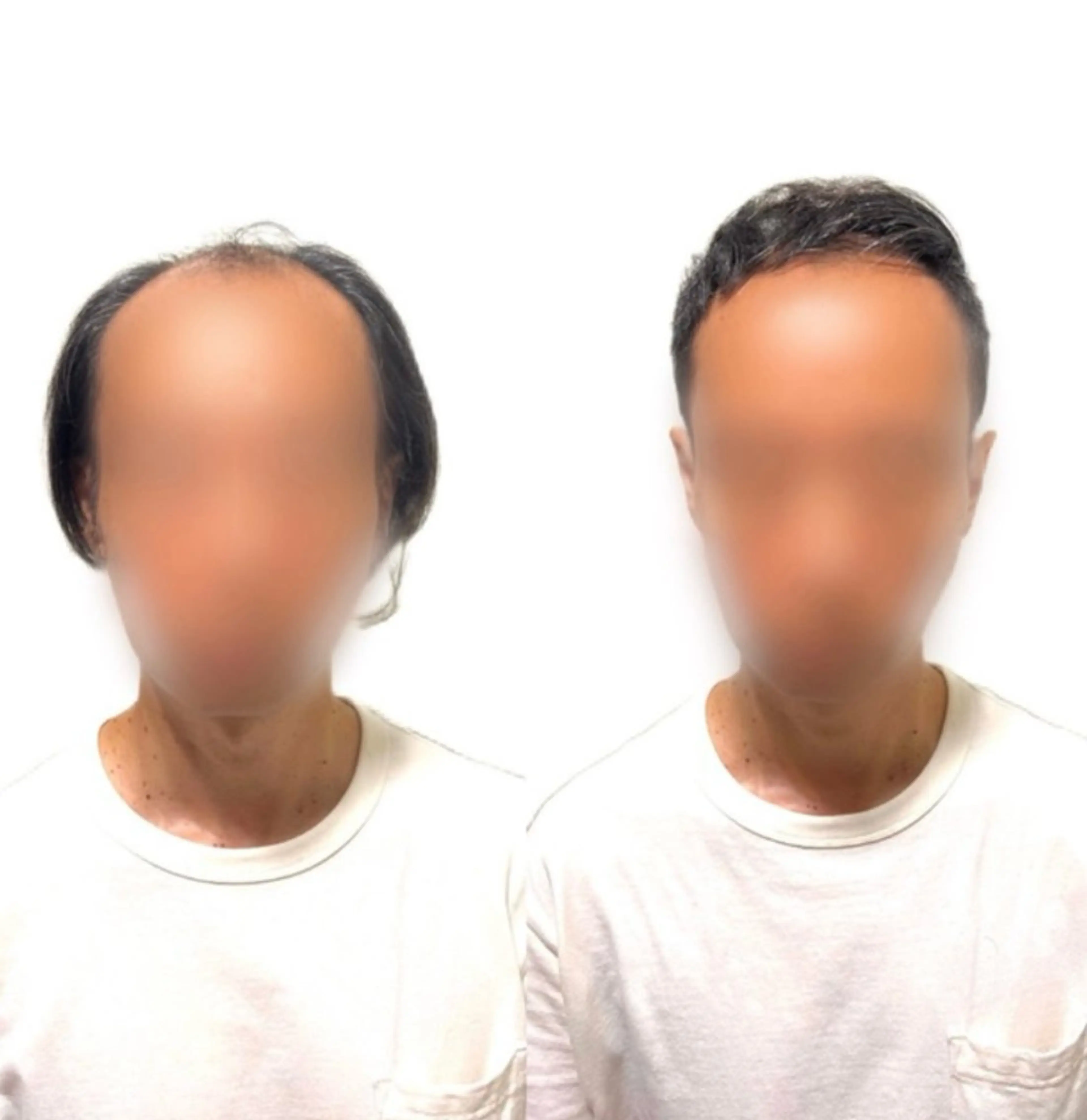 メンズ 薄毛専門美容師 和久井博のその他イメージ