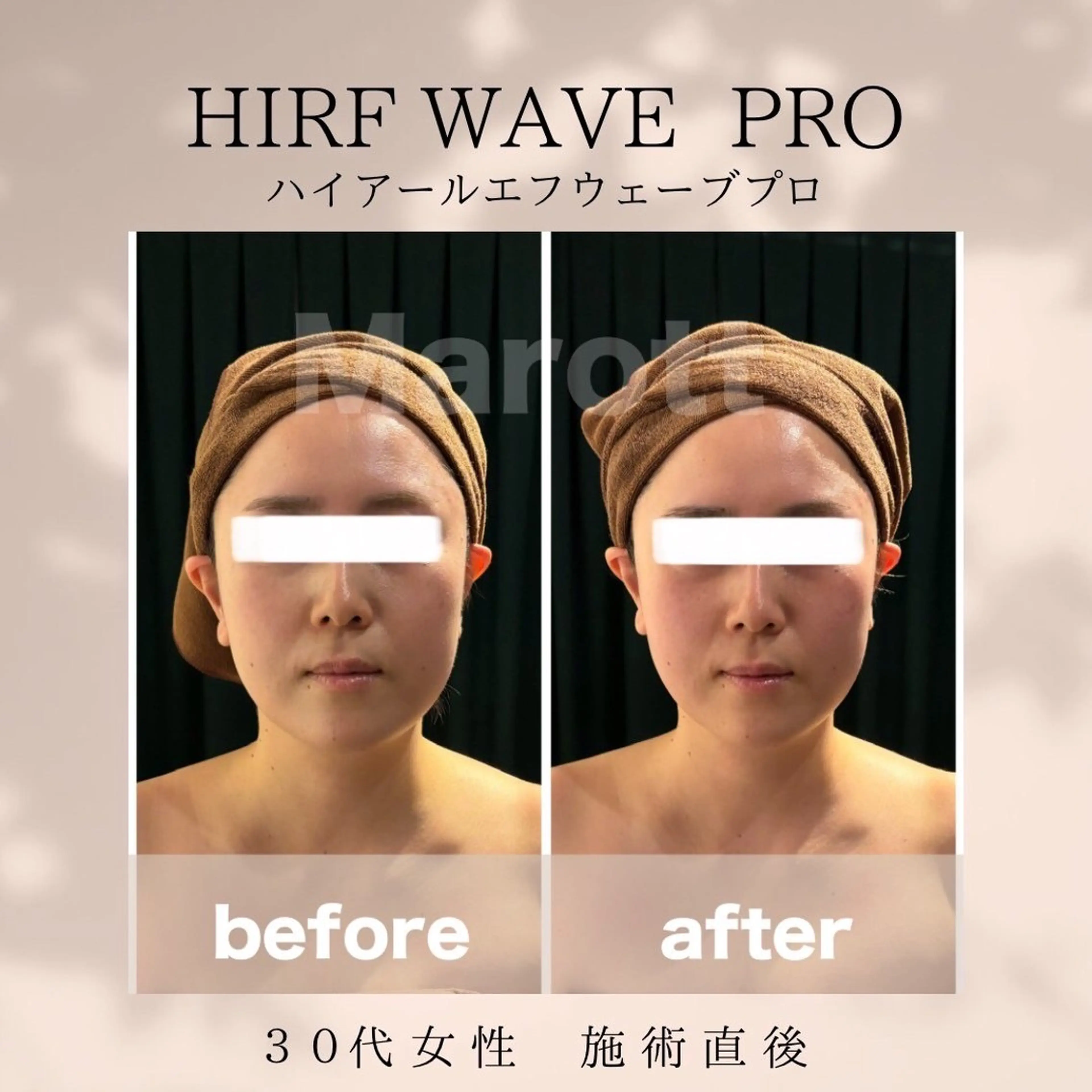 小顔サロン Marottのエステ・リラクイメージ