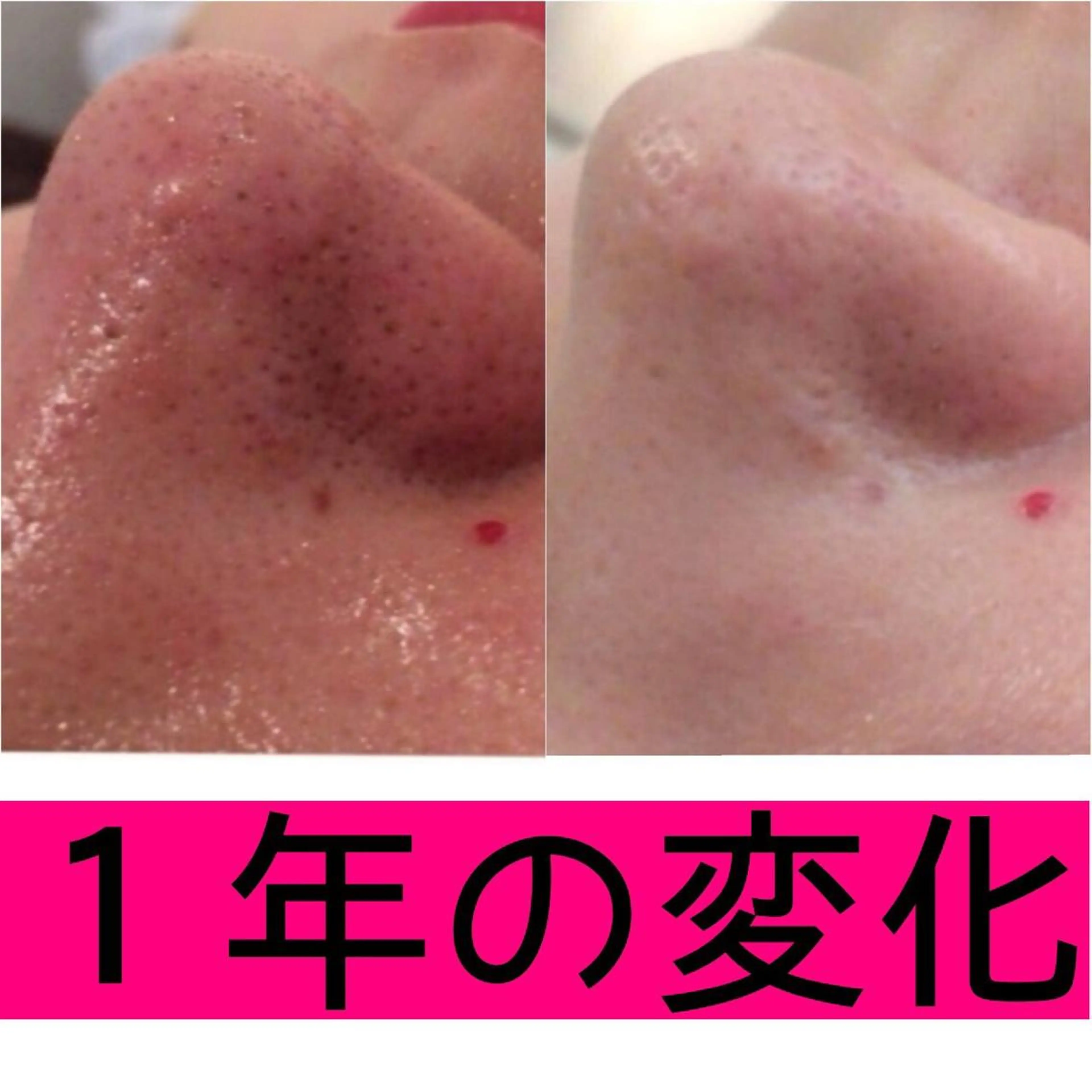 ミディアム パーマ ヘアアレンジ メンズ キッズ ネイル マツエク・マツパ ニキビ・肌質改善専門 ♡人生が変わるサロンのエステ・リラクイメージ