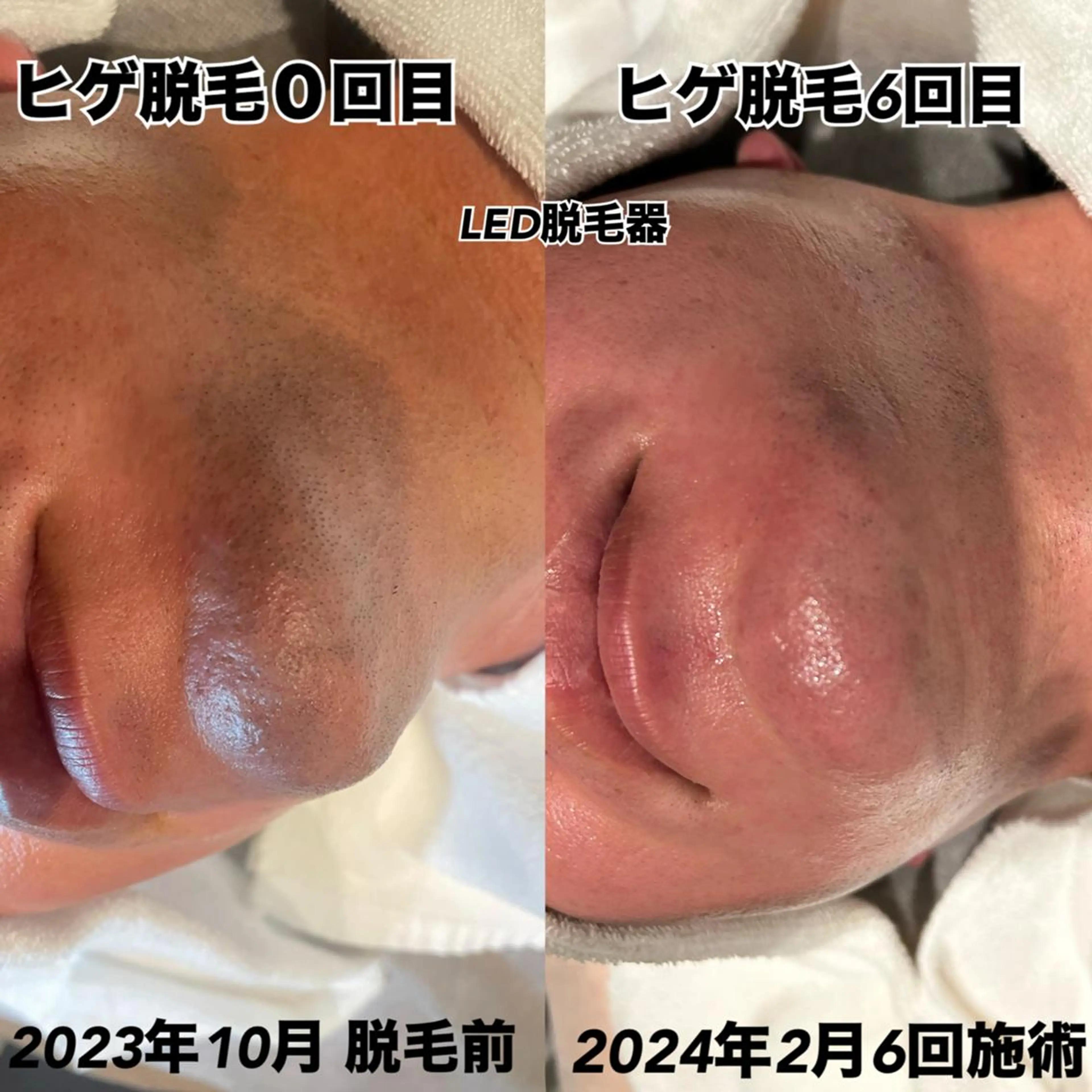 脱毛・眉毛・フェイス サロンN久留米店のその他イメージ