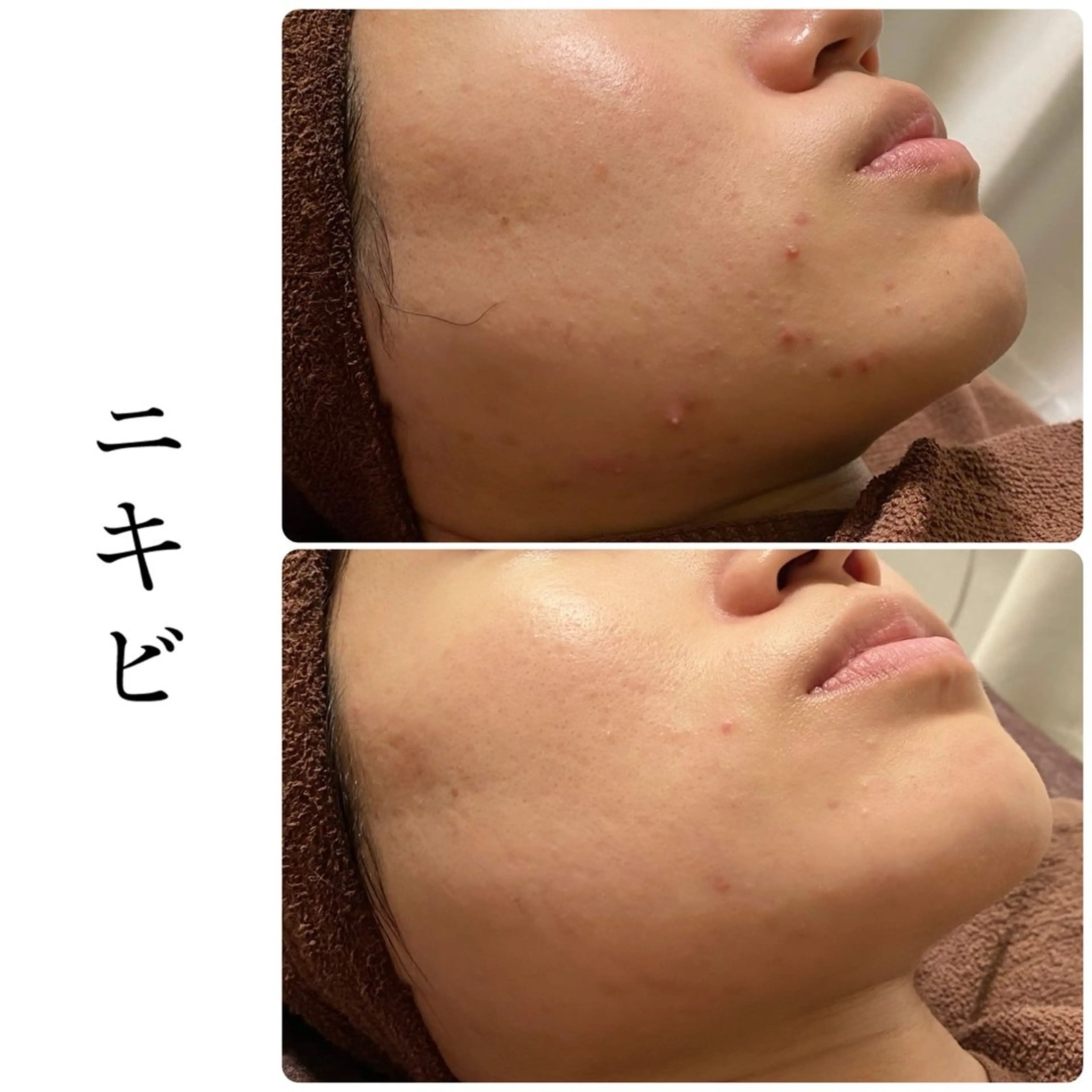 ハーブピーリング専門 BIOEL横浜のエステ・リラクイメージ