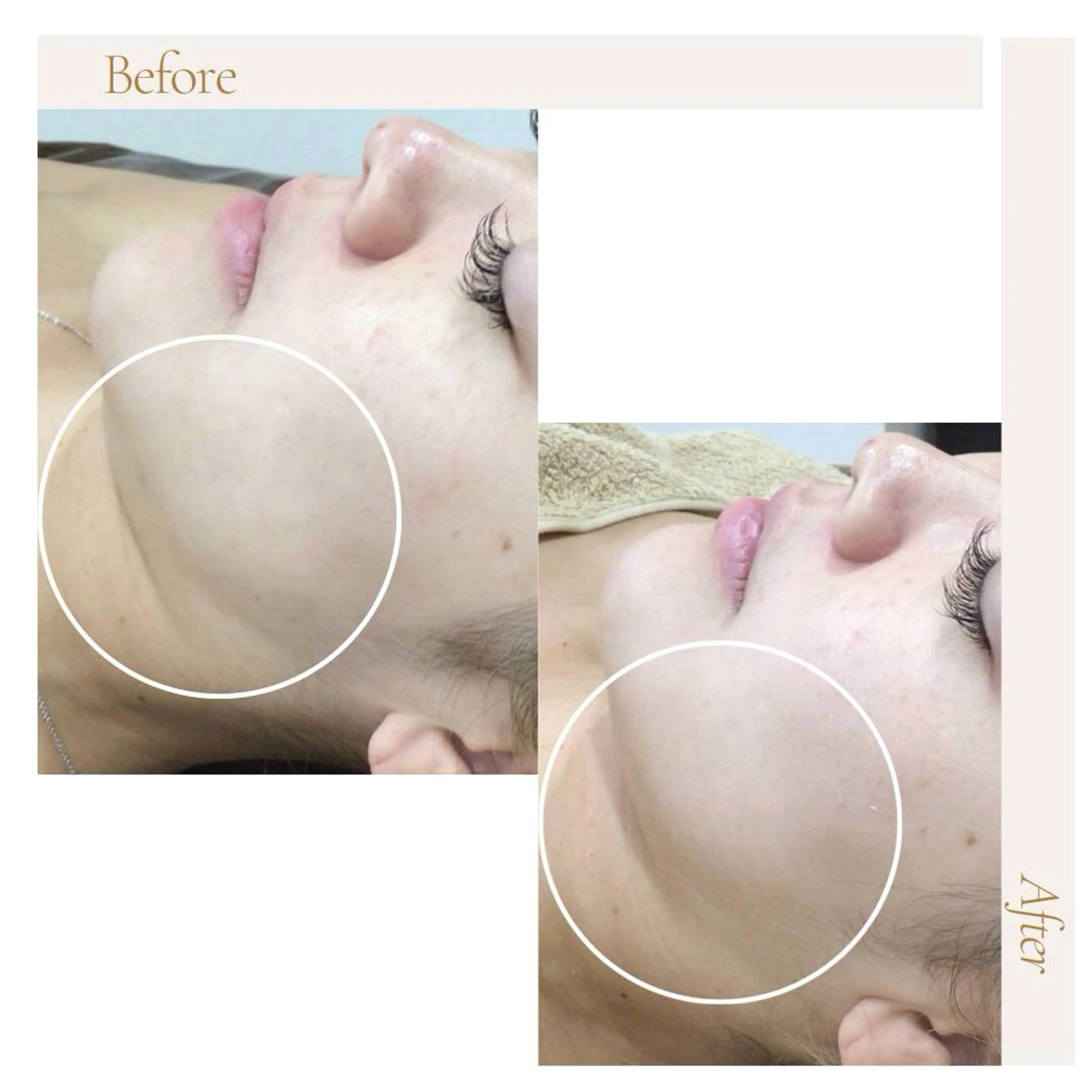 アイアンド ネイルデイのエステ・リラクイメージ