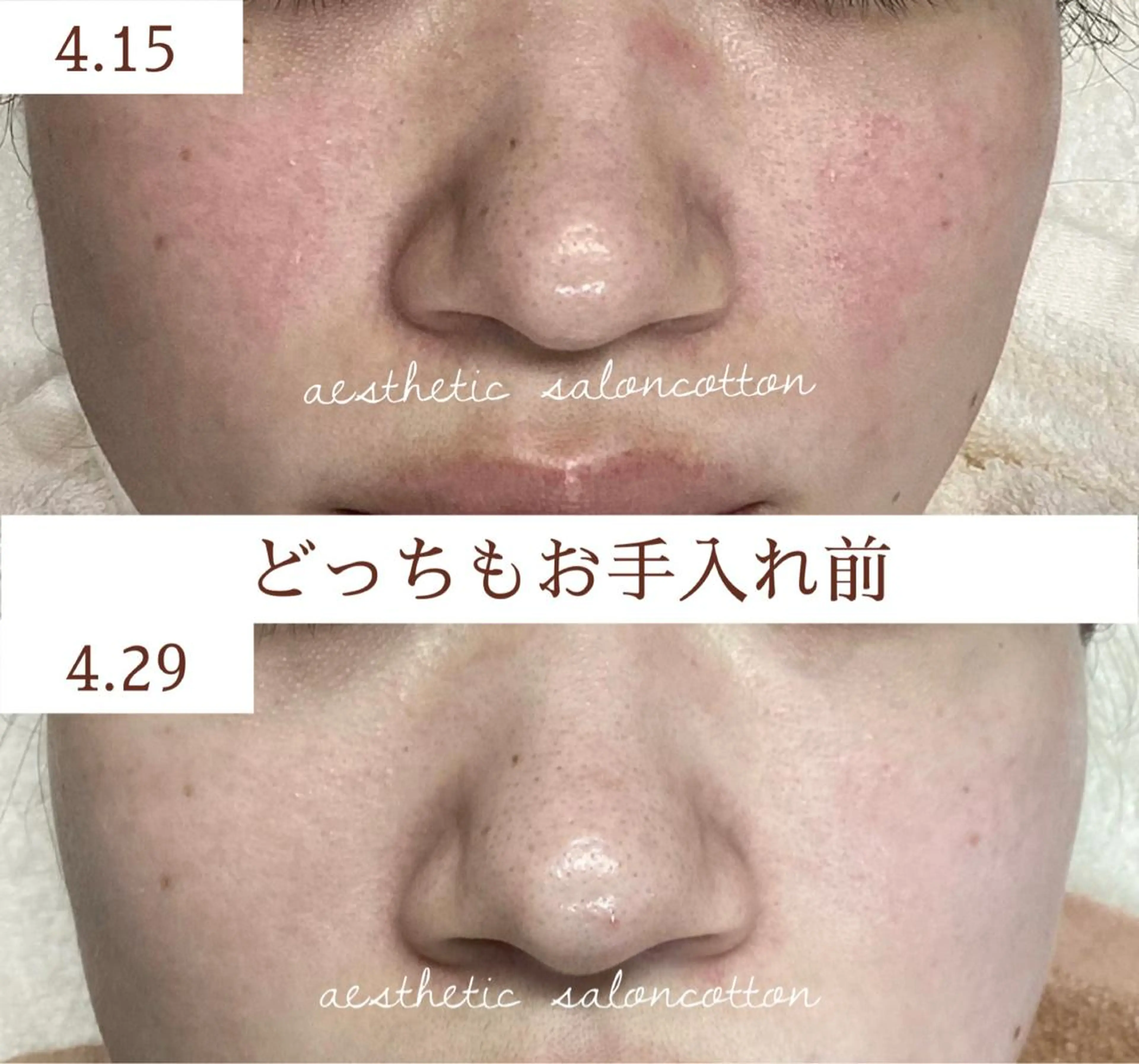 都度払い 肌質改善専門サロンのエステ・リラクイメージ