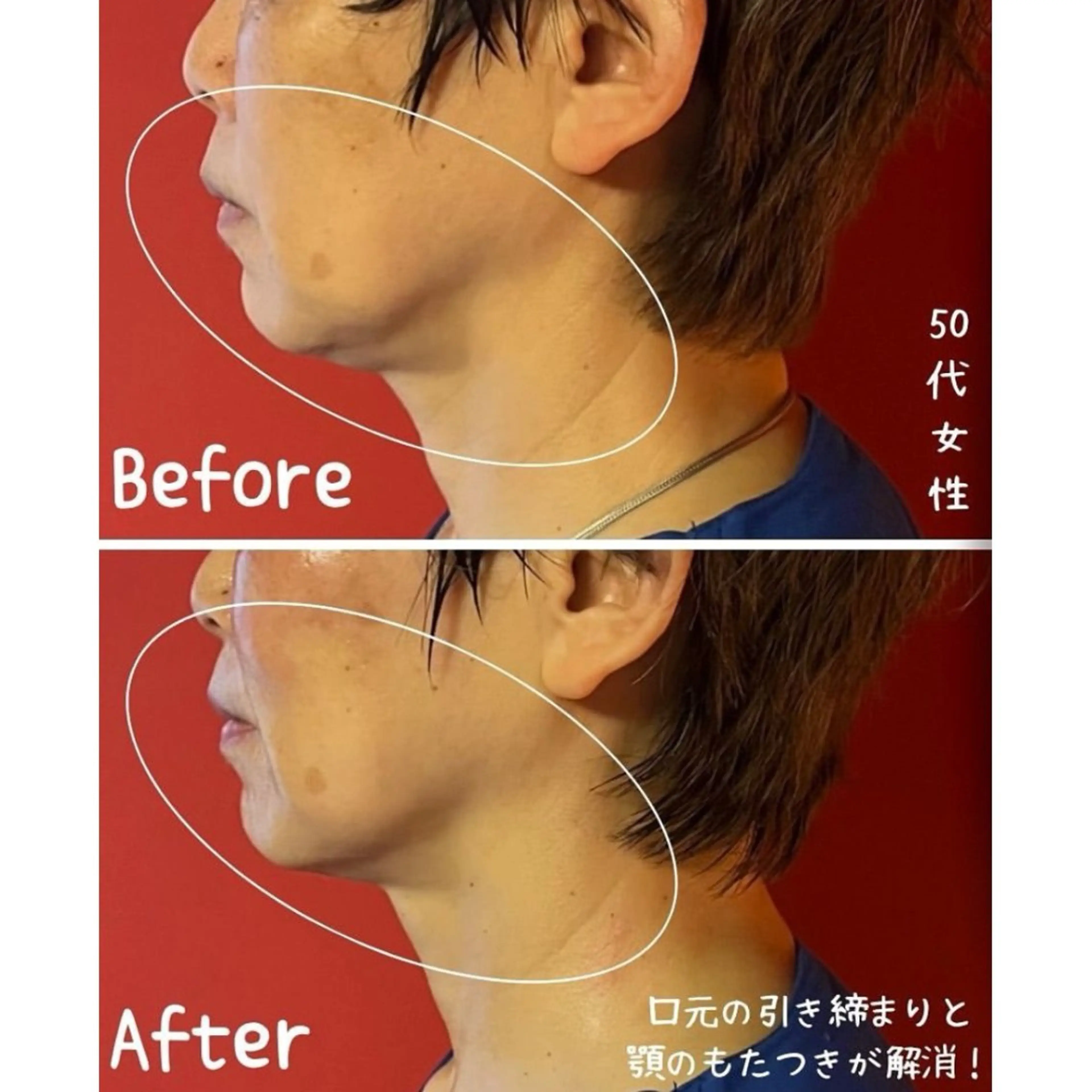 エステ リラク 表情筋フェイシャル 三軒茶屋のエステ・リラクイメージ