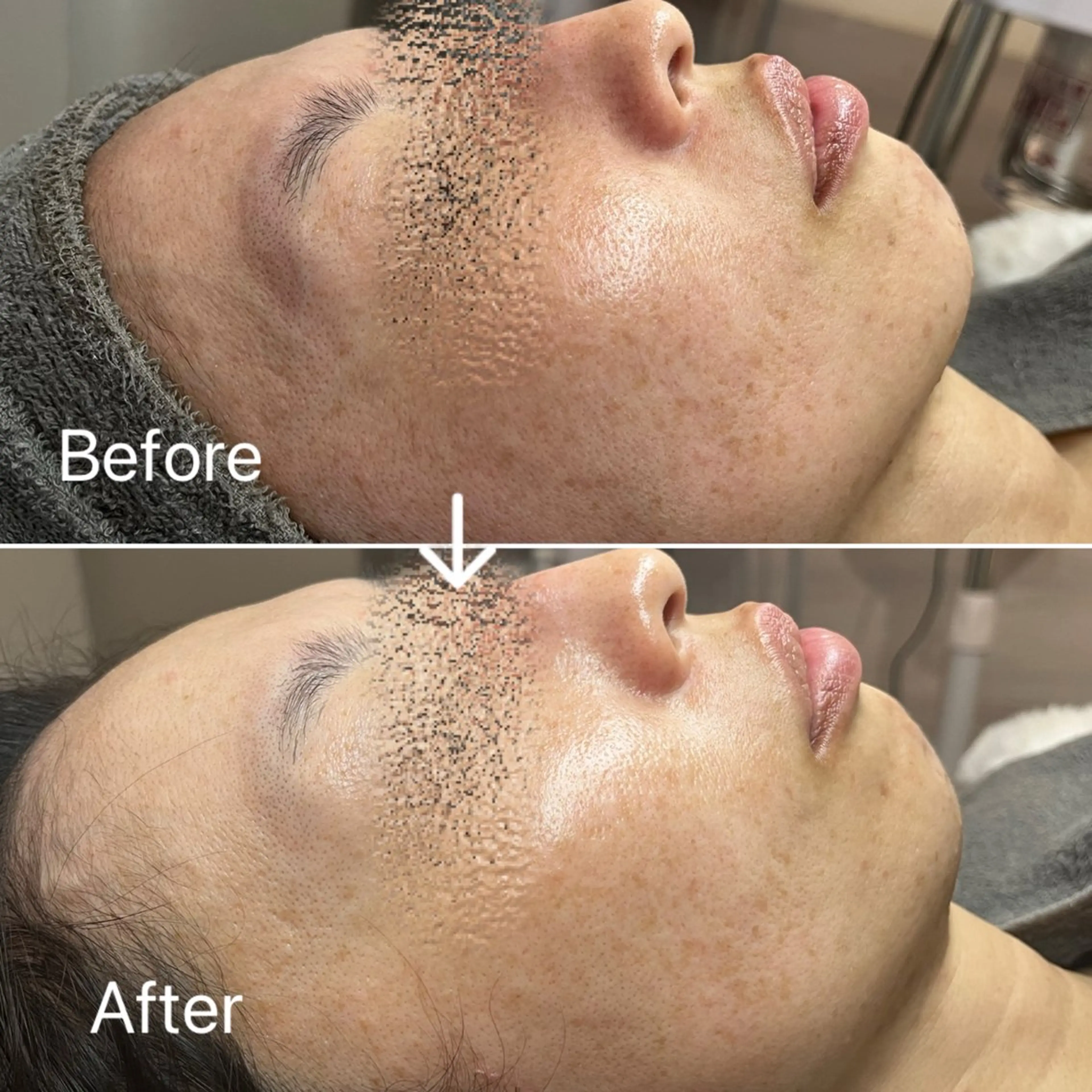 Blue Moon 【ブルームーン】のエステ・リラクイメージ