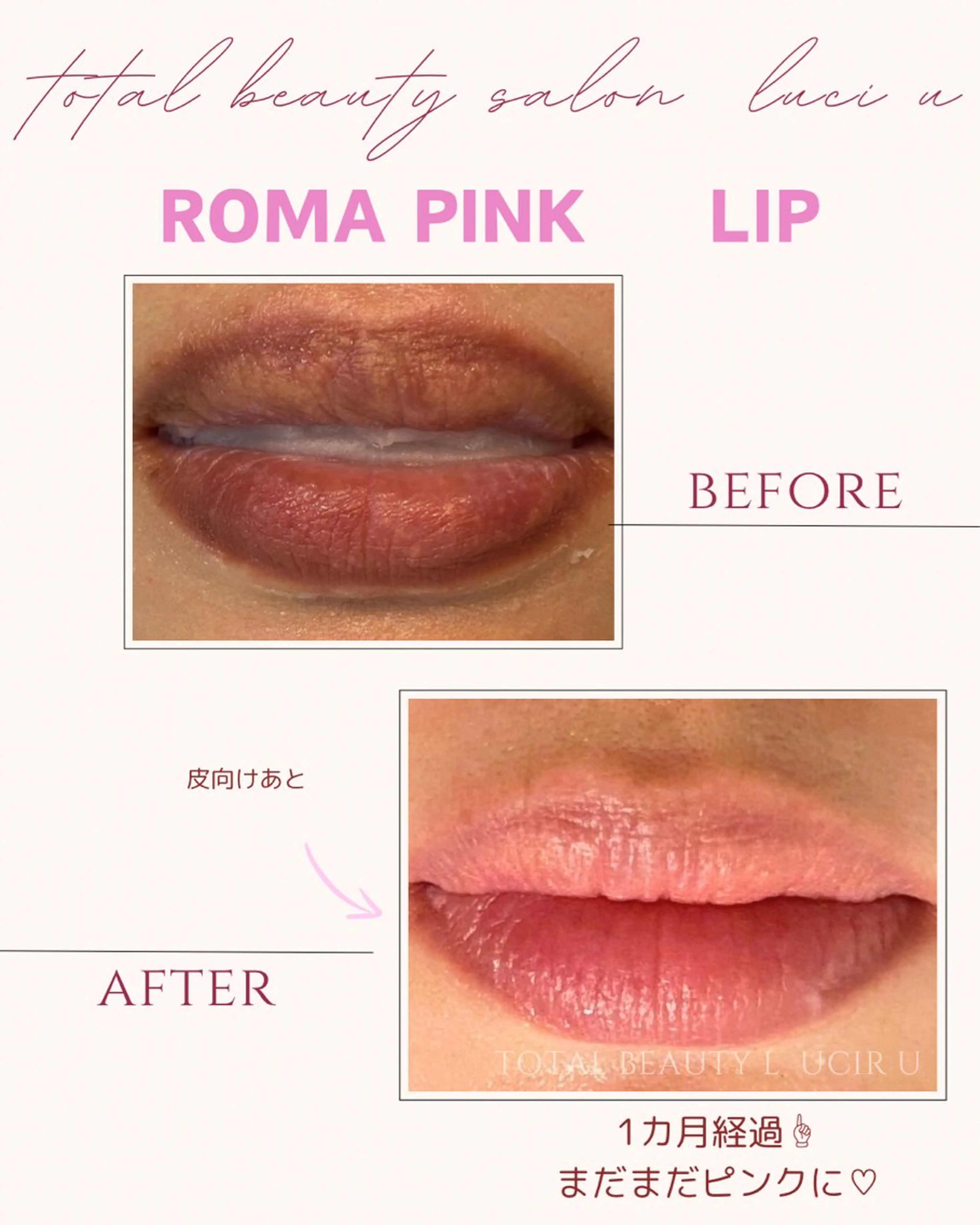 エステ ルシール ユーのエステ・リラクイメージ