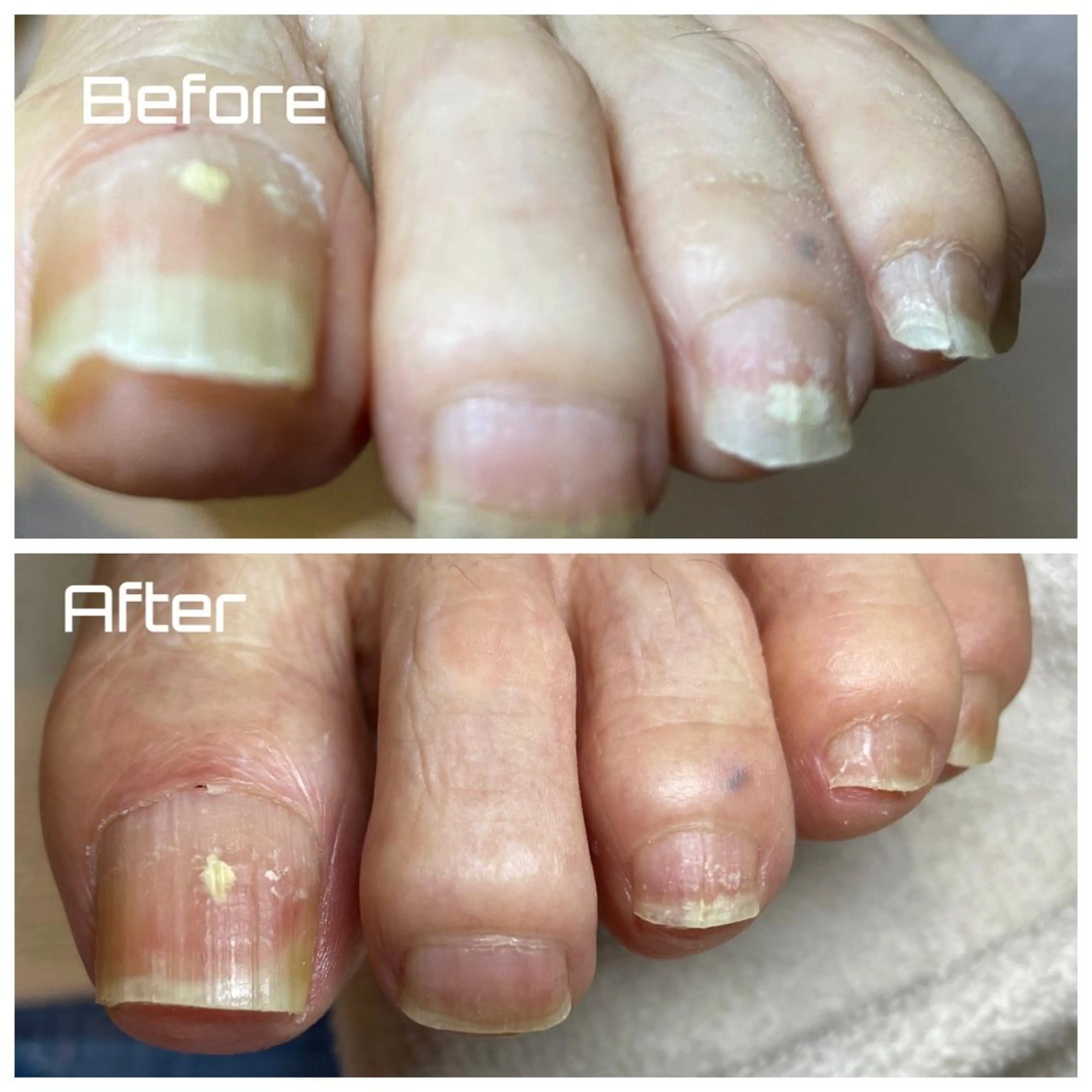 その他 ドクターネイル爪革命 takahashiのその他イメージ