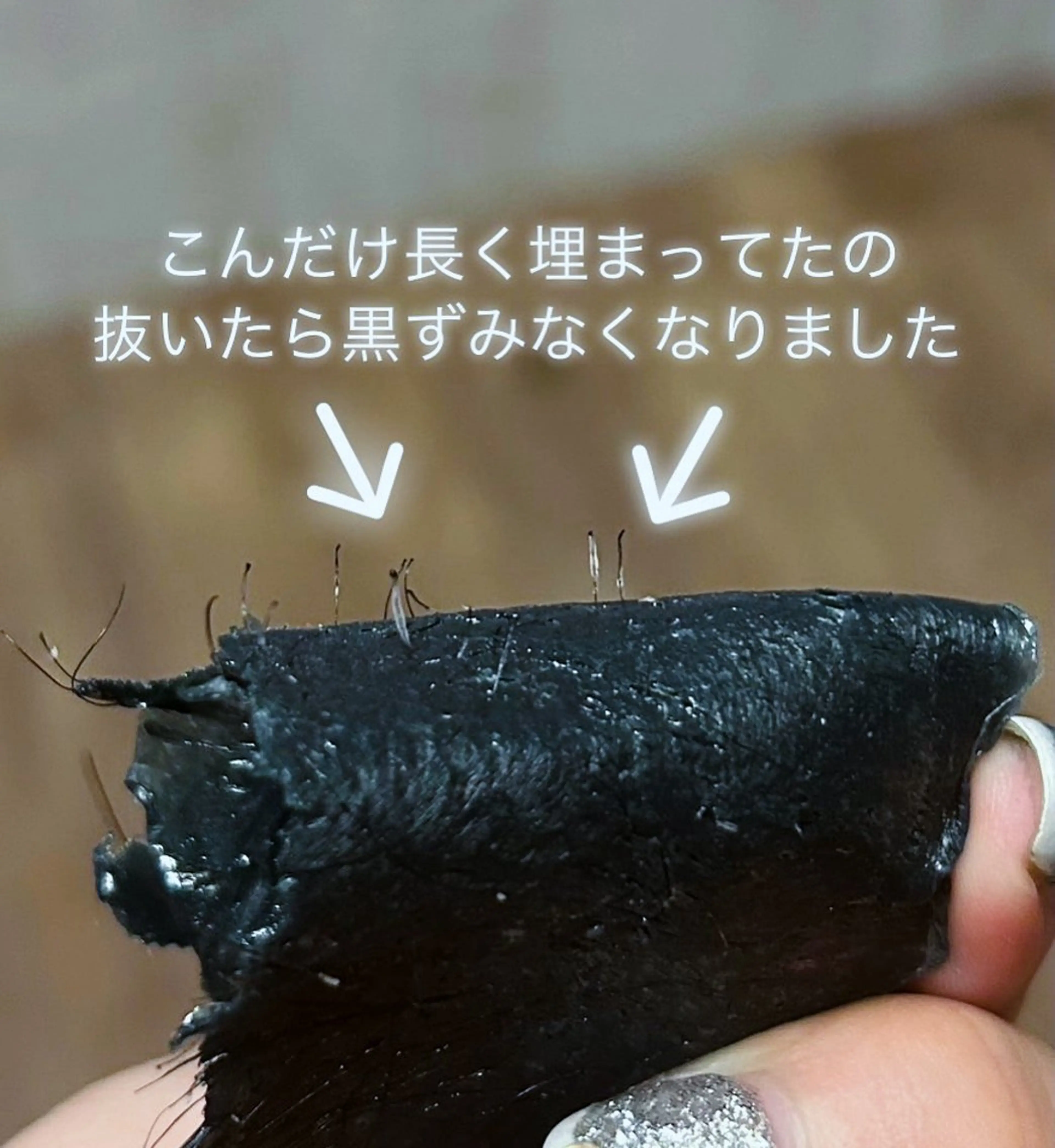 脱毛 evergreen /眉毛•耳つぼのエステ・リラクイメージ