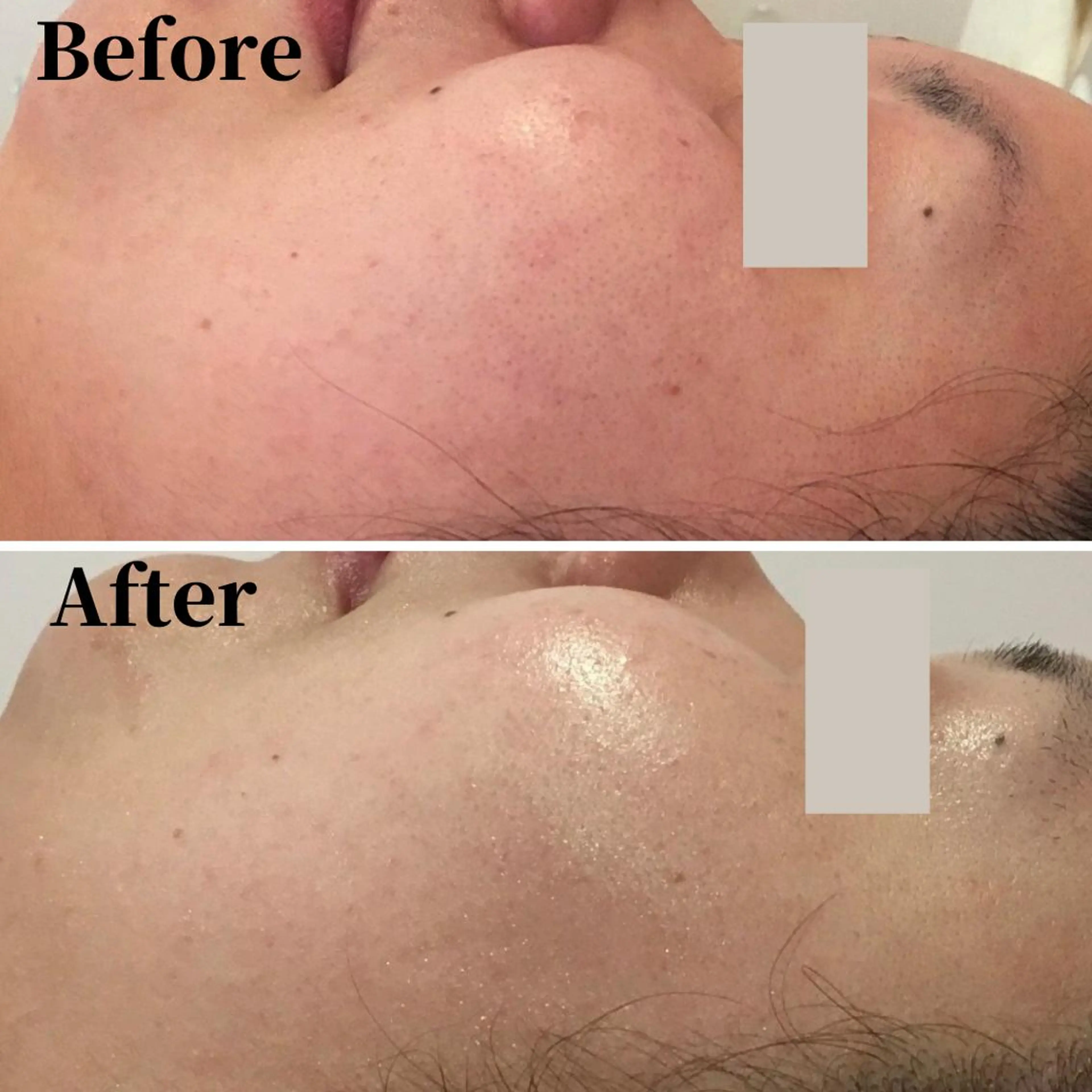 《リピーター様限定》【肌細胞修復機械&生コラーゲン導入&生ビタミンC導入で透明感アップ♡】ワンランク上のスペシャルケアの写真