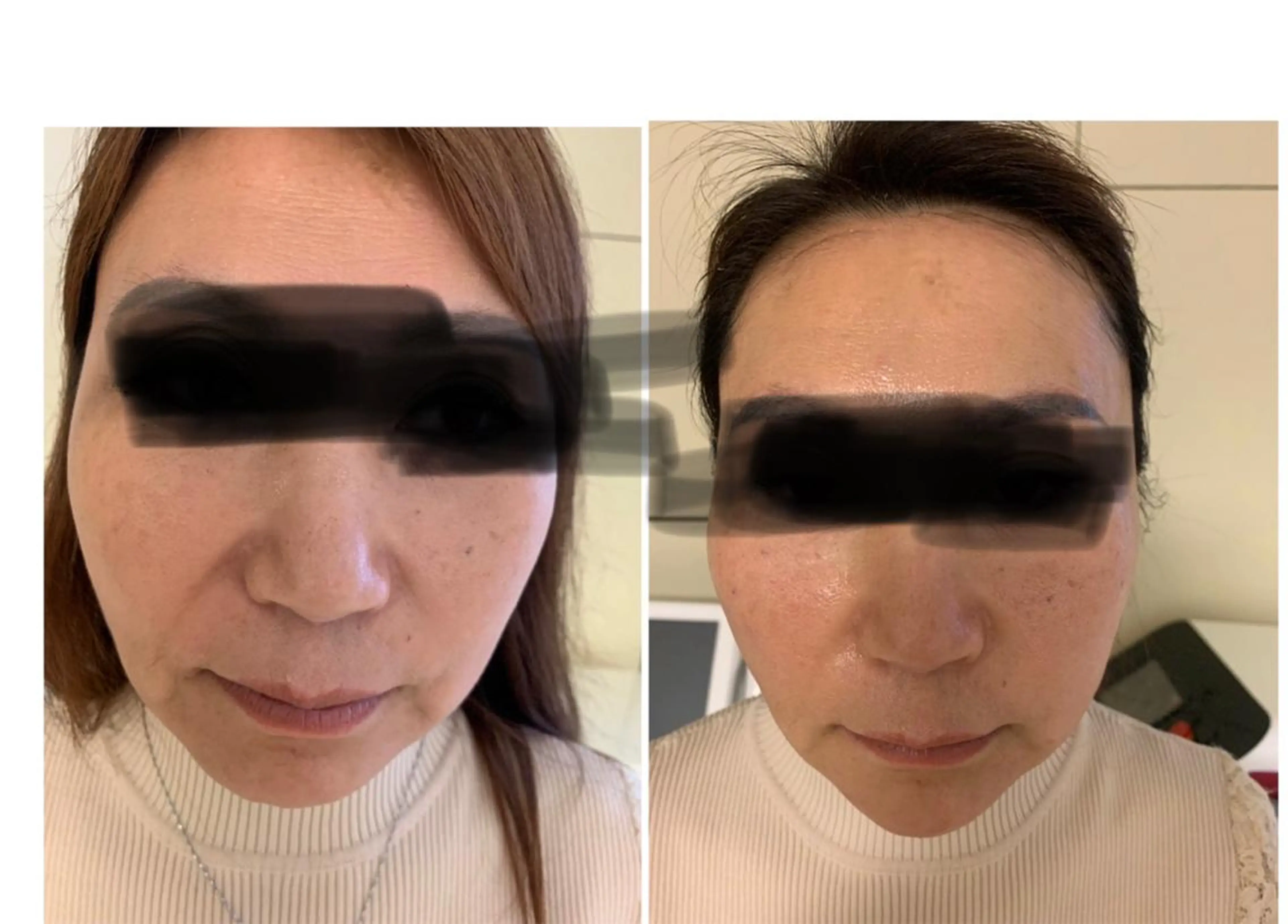 エステ aliaハイフ&水光ジェットサロン所属・aliaハーブ水光店 エステティシャン募集のエステ・リラクイメージ