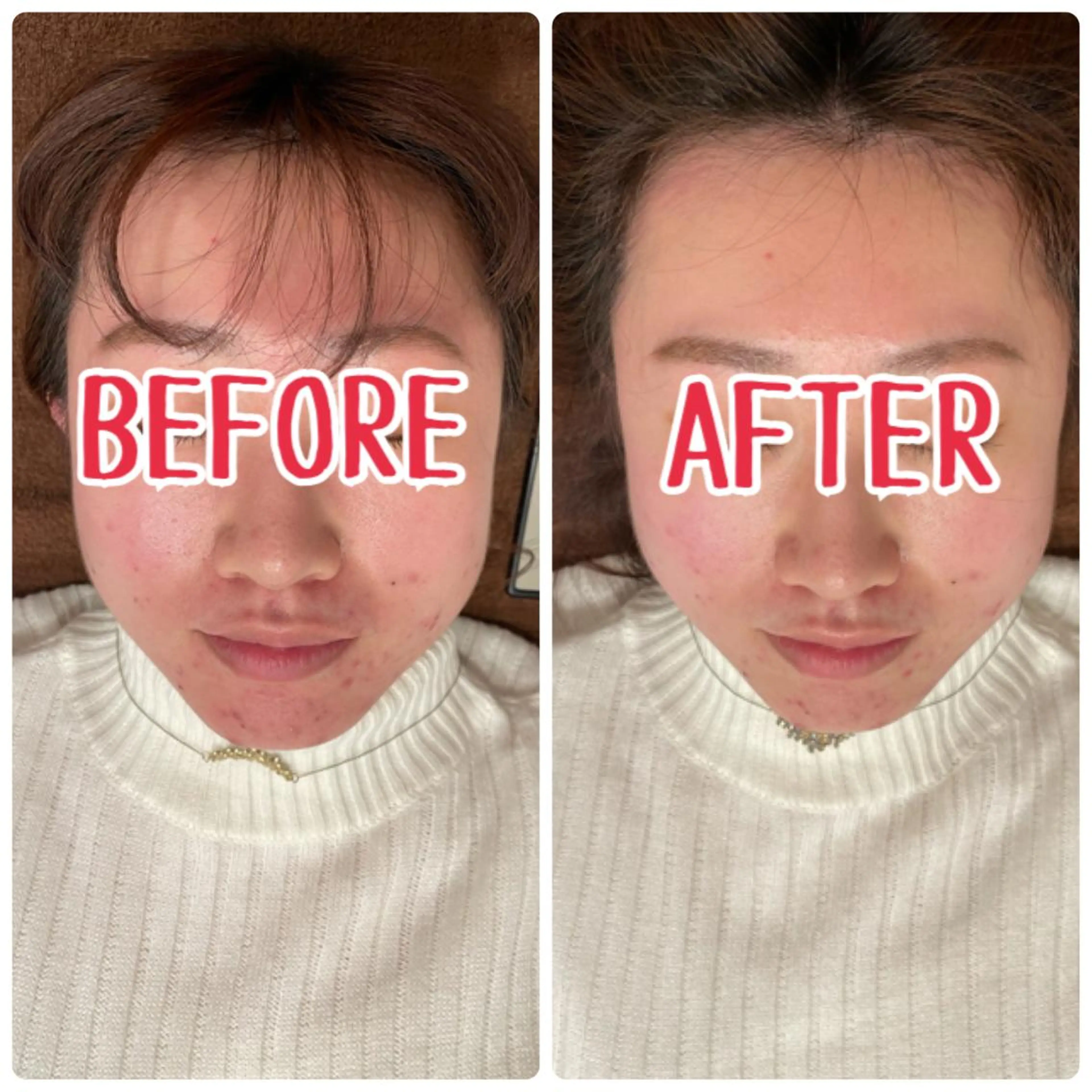 ジェイペック所属・整体×美容鍼 ジェイペックのエステ・リラクイメージ