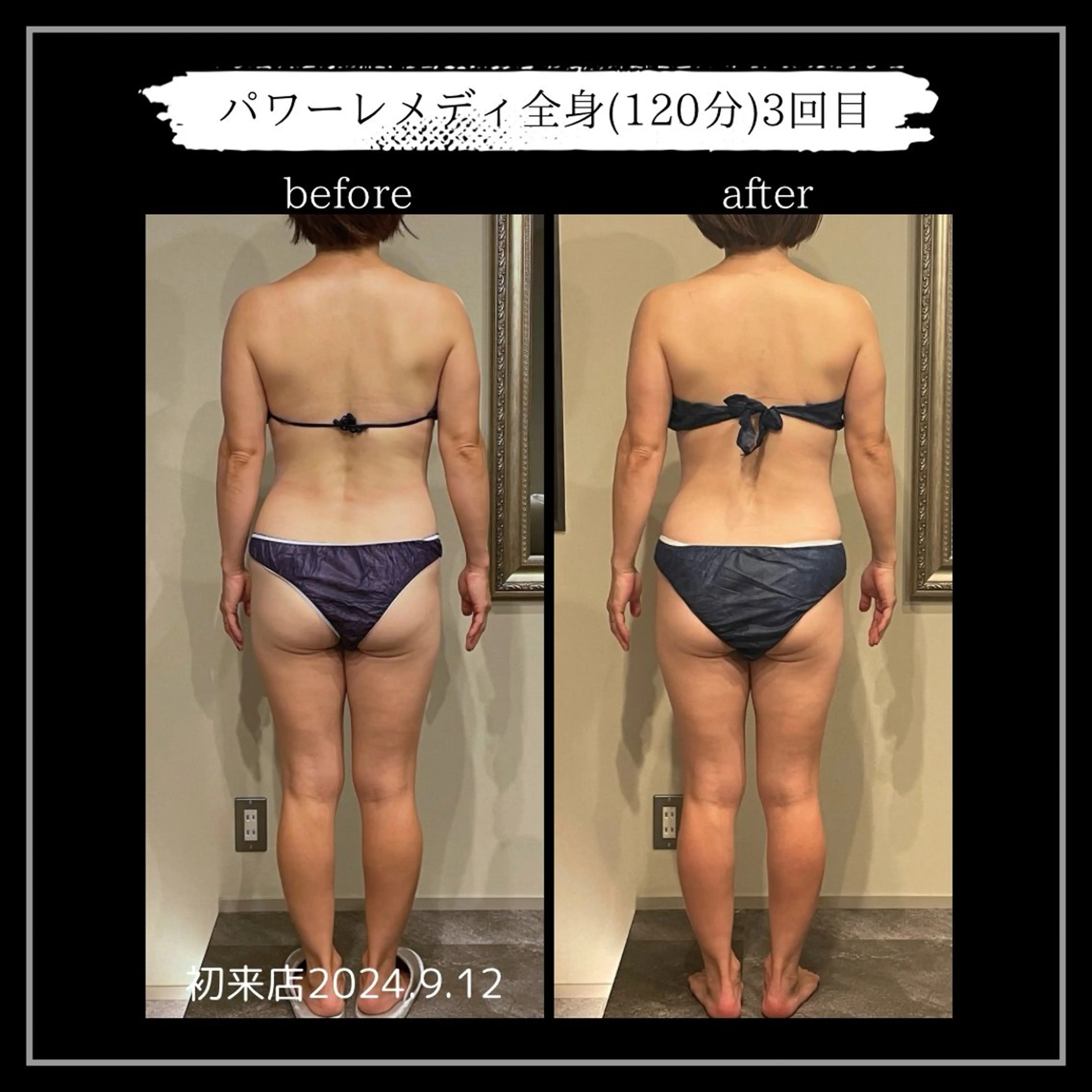 オフ:オン所属・オフ:オン 全身筋膜マッサージのエステ・リラクイメージ