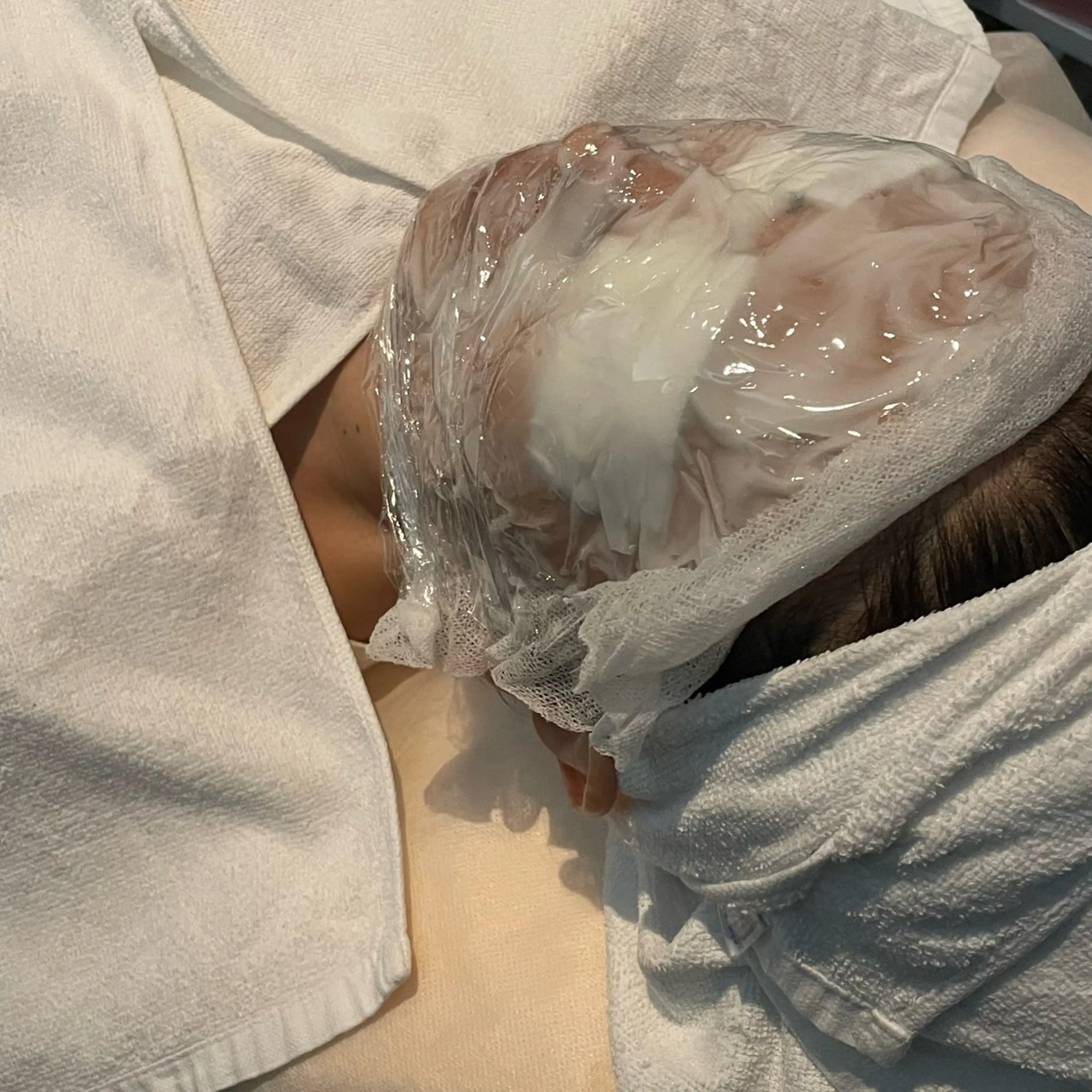 エステ NARIS BEAUTY STATION　デ・アイム あべのルシアス所属・ニキビ跡/毛穴/ 肌質改善/北村ももこのエステ・リラクイメージ