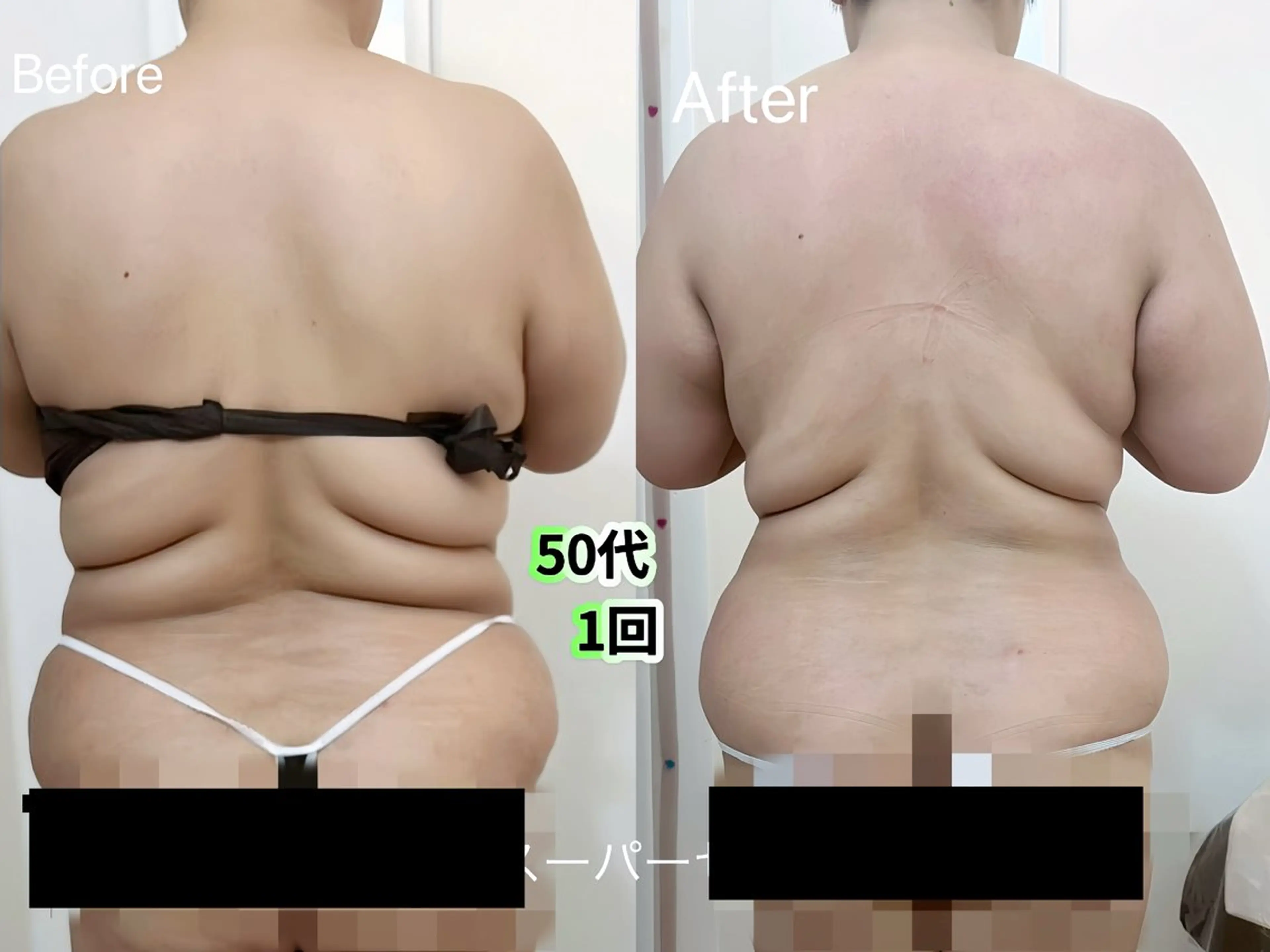 痩身&小顔サロン L i l yA sのエステ・リラクイメージ