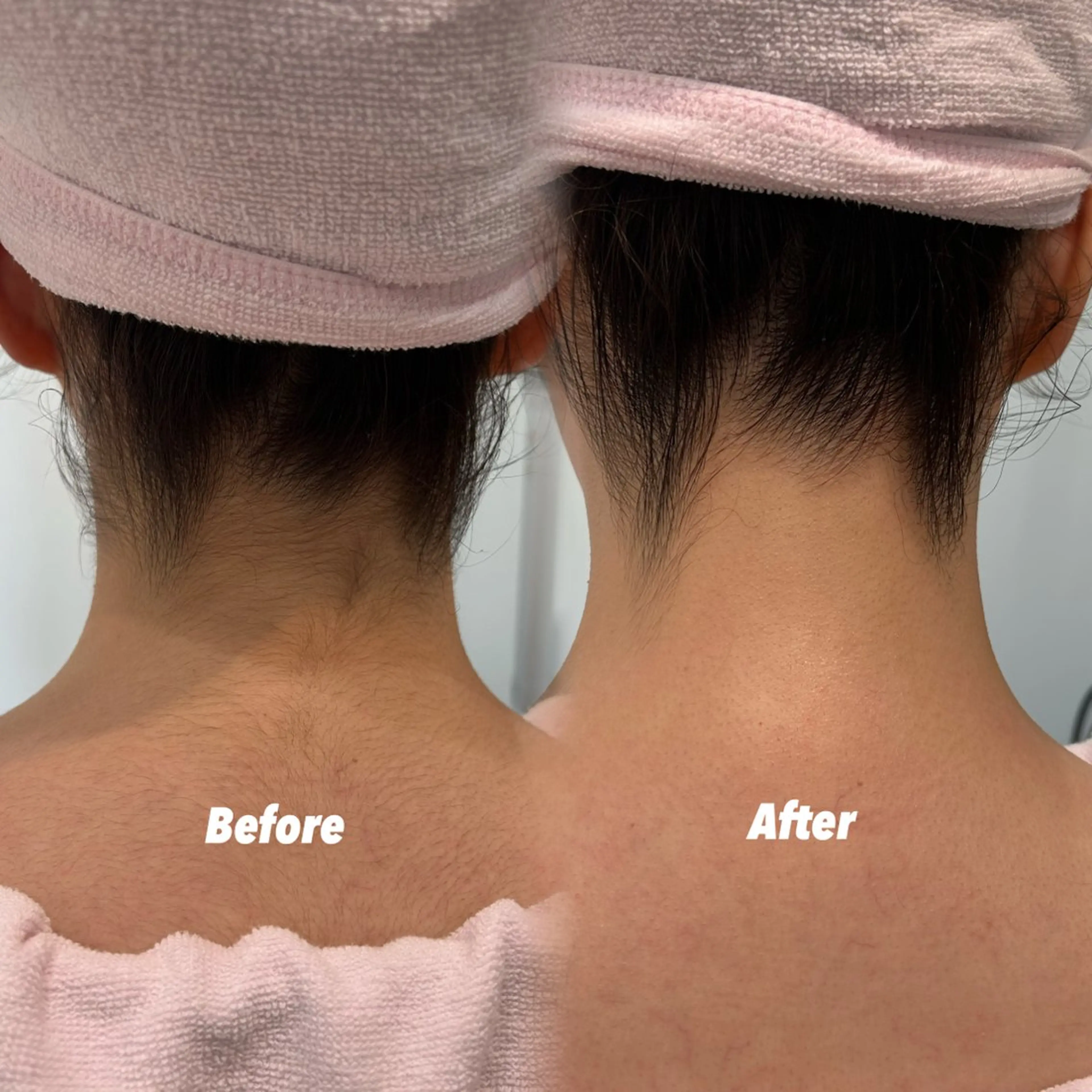 エステ リラク 🫧美しい素肌へ🫧 今成柚乃のその他イメージ