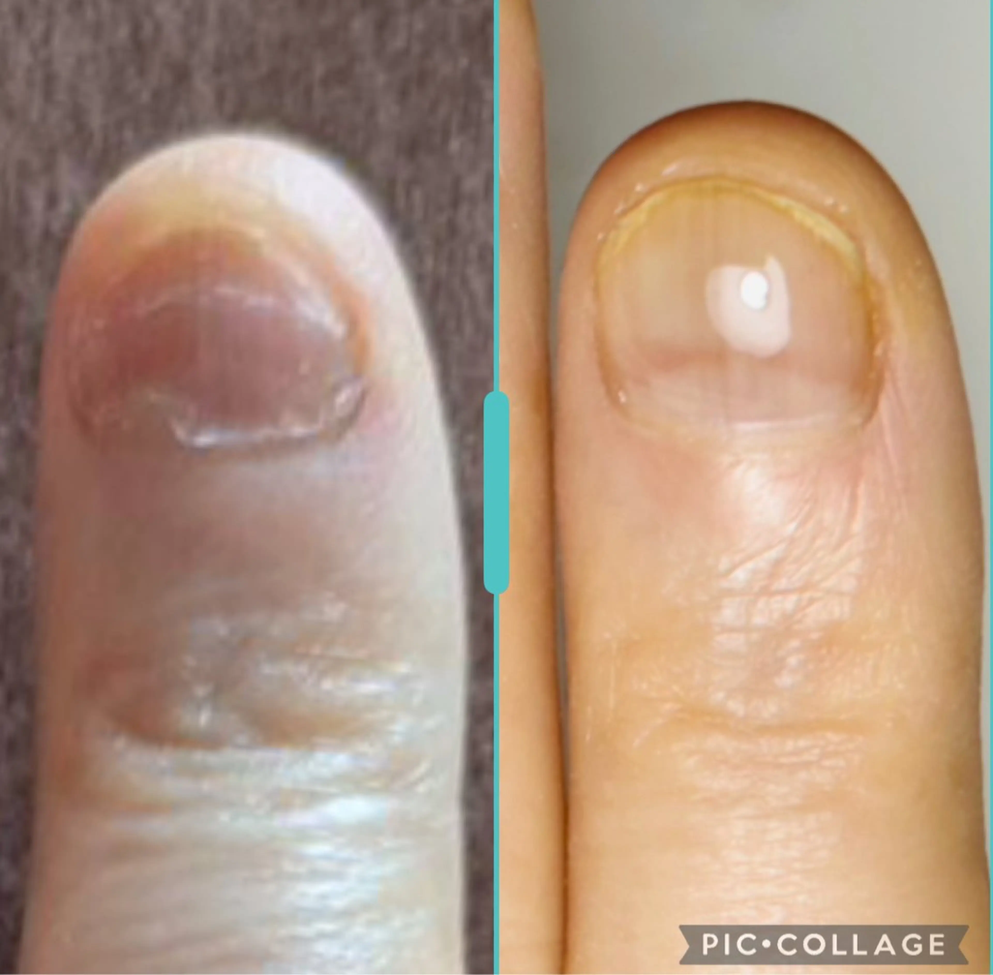 ネイル 深爪・自爪育成専門 MAHALOHIのネイルデザイン