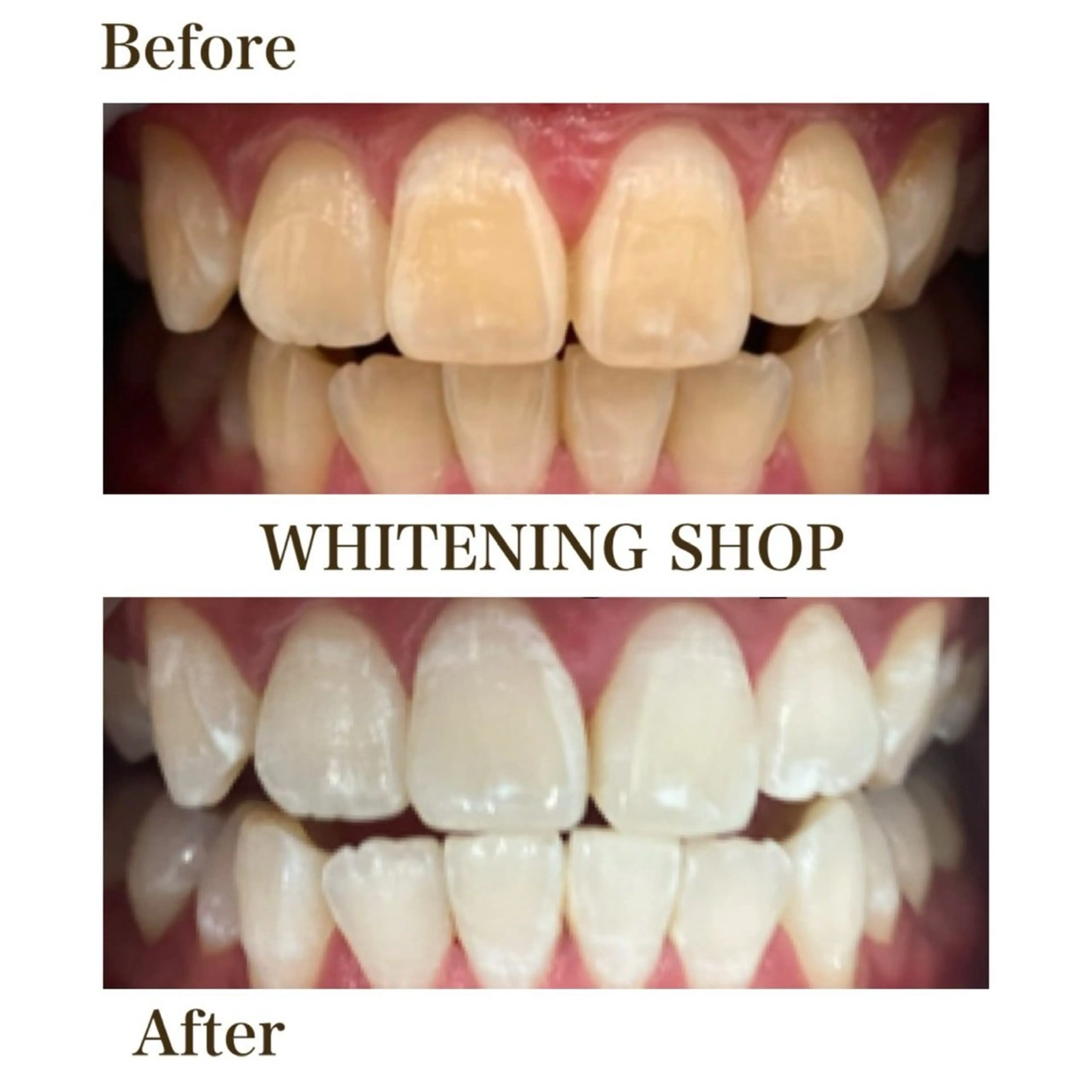 その他 ホワイトニングショップ静岡葵区店所属・ホワイトニング ショップ静岡葵区店のその他イメージ