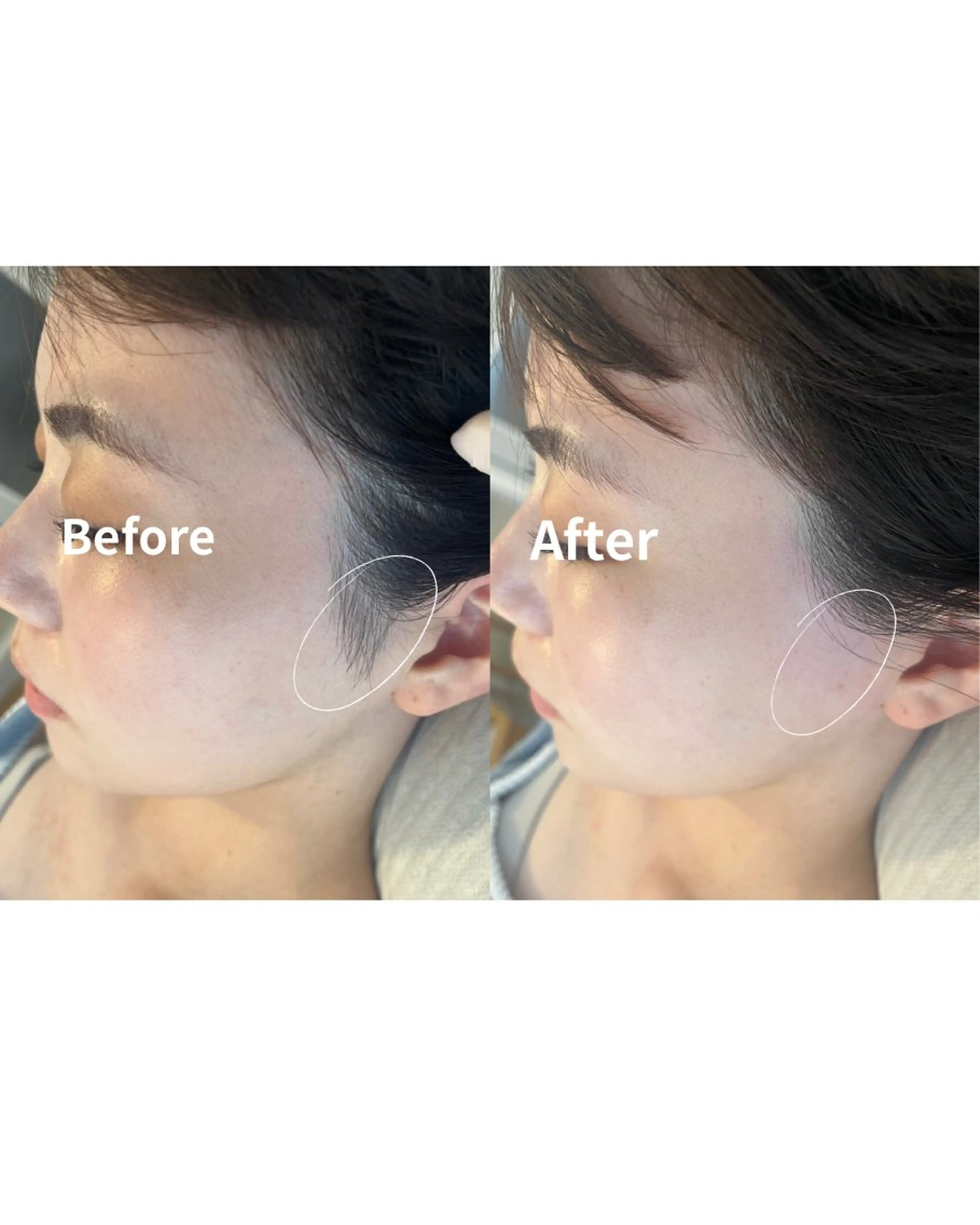 脱毛 MASAMI マサミのエステ・リラクイメージ