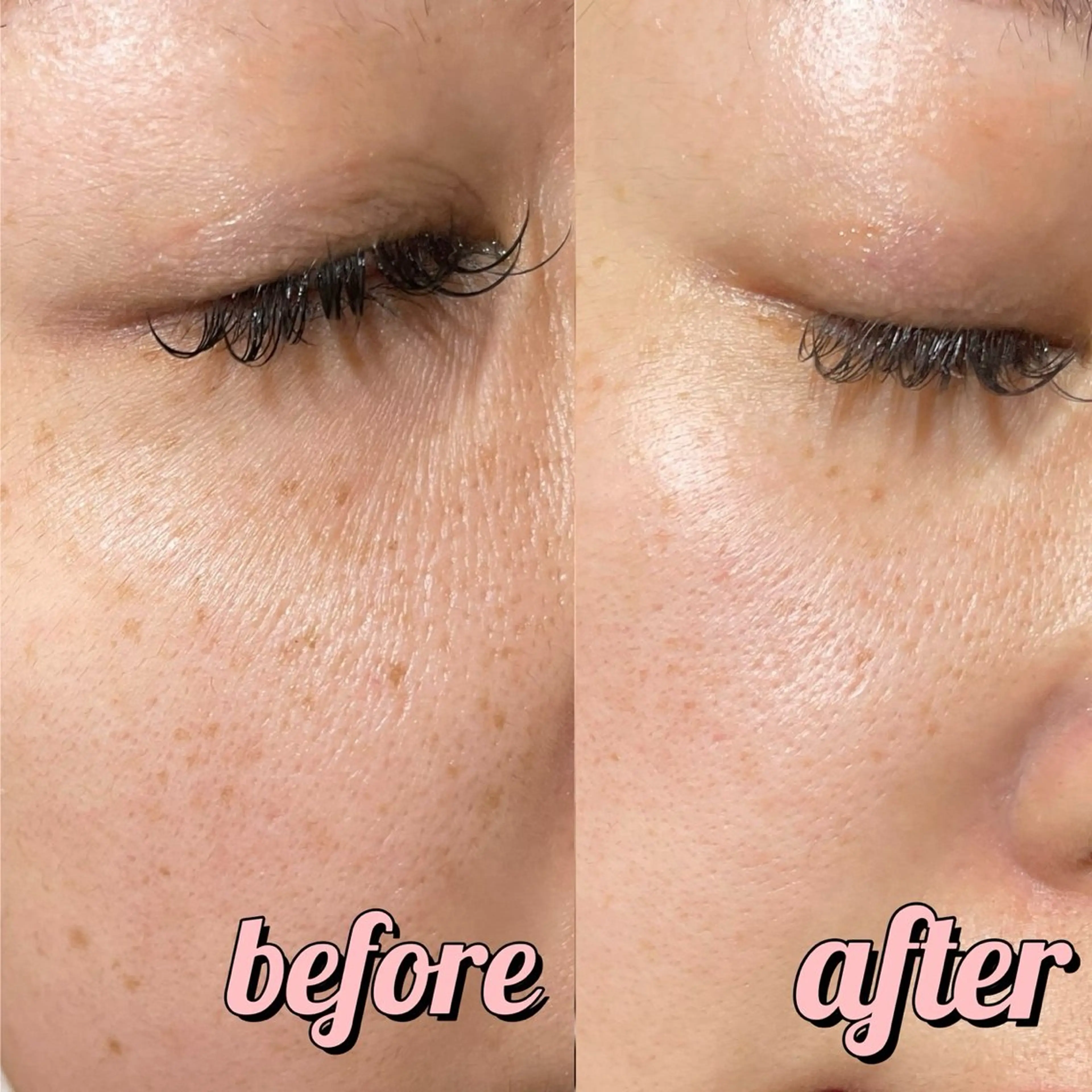 曽根 理奈のエステ・リラクイメージ