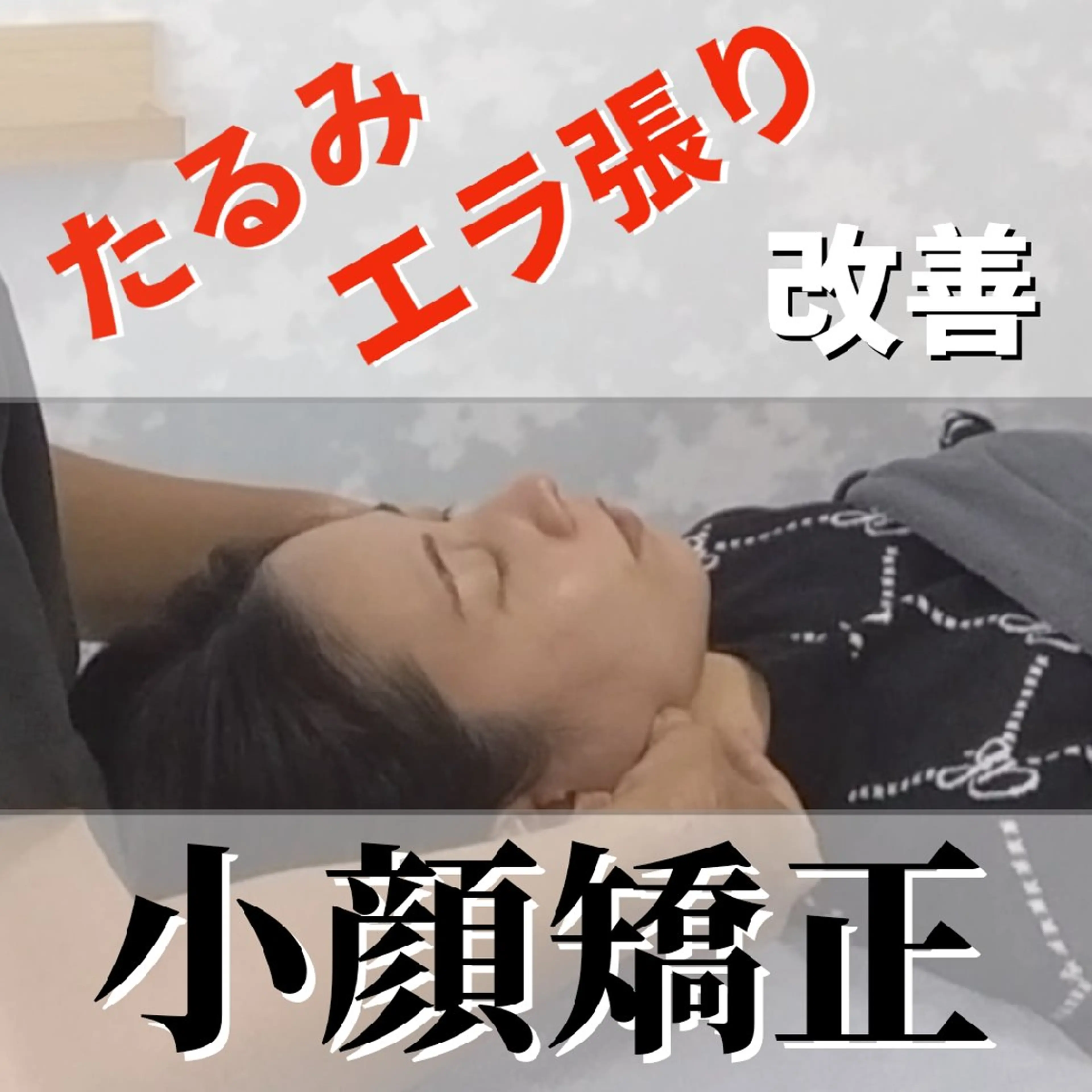 たるみ専門美容鍼 × 猫背整体 のぐち所属・小顔と姿勢改善のプロ ｜整体と美容鍼のぐちのエステ・リラクイメージ