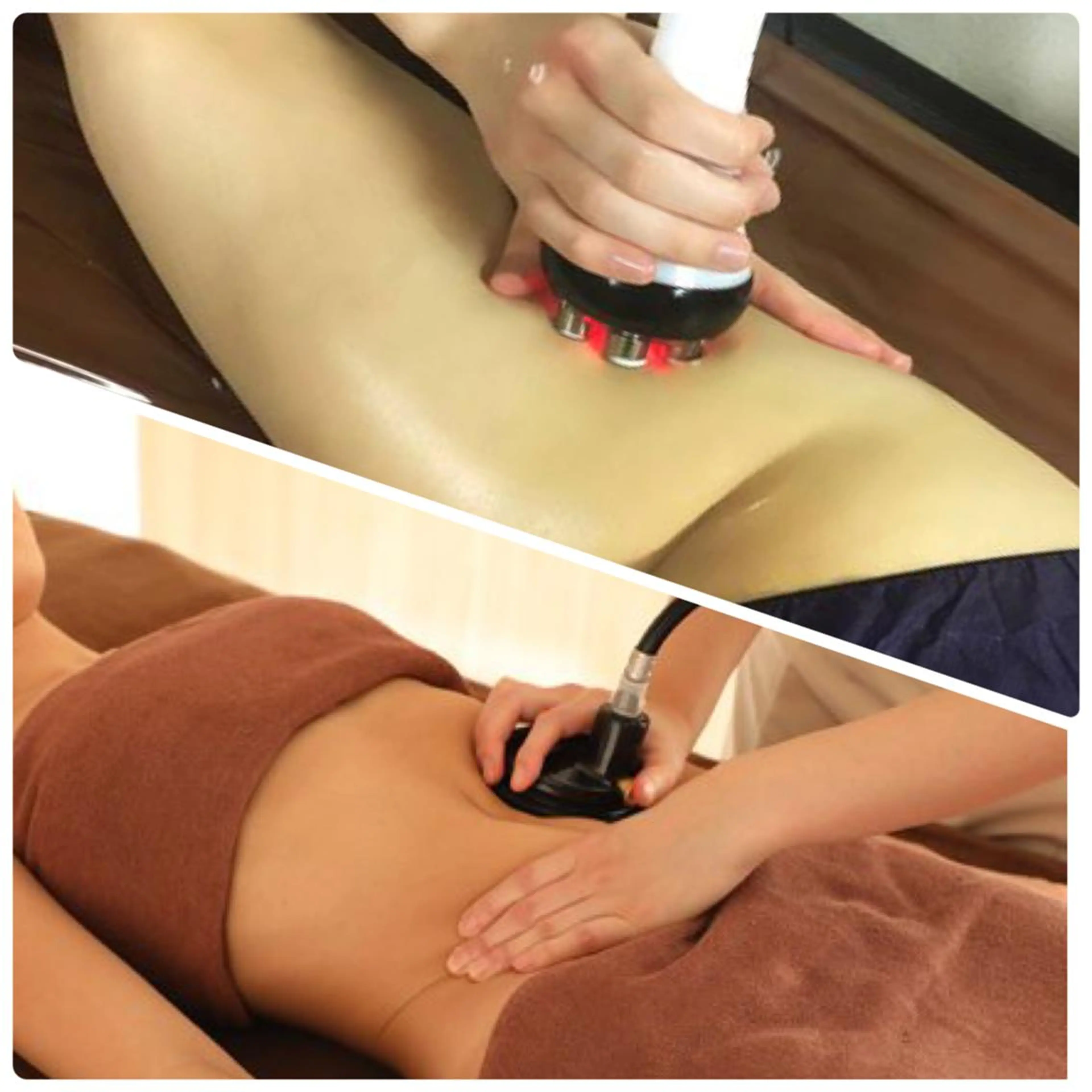 💥結果重視💥【6980円→3980円】🔥ハイパーナイフ＋全身吸引コース🔥ガチガチに固まった贅肉を撃退！！の写真