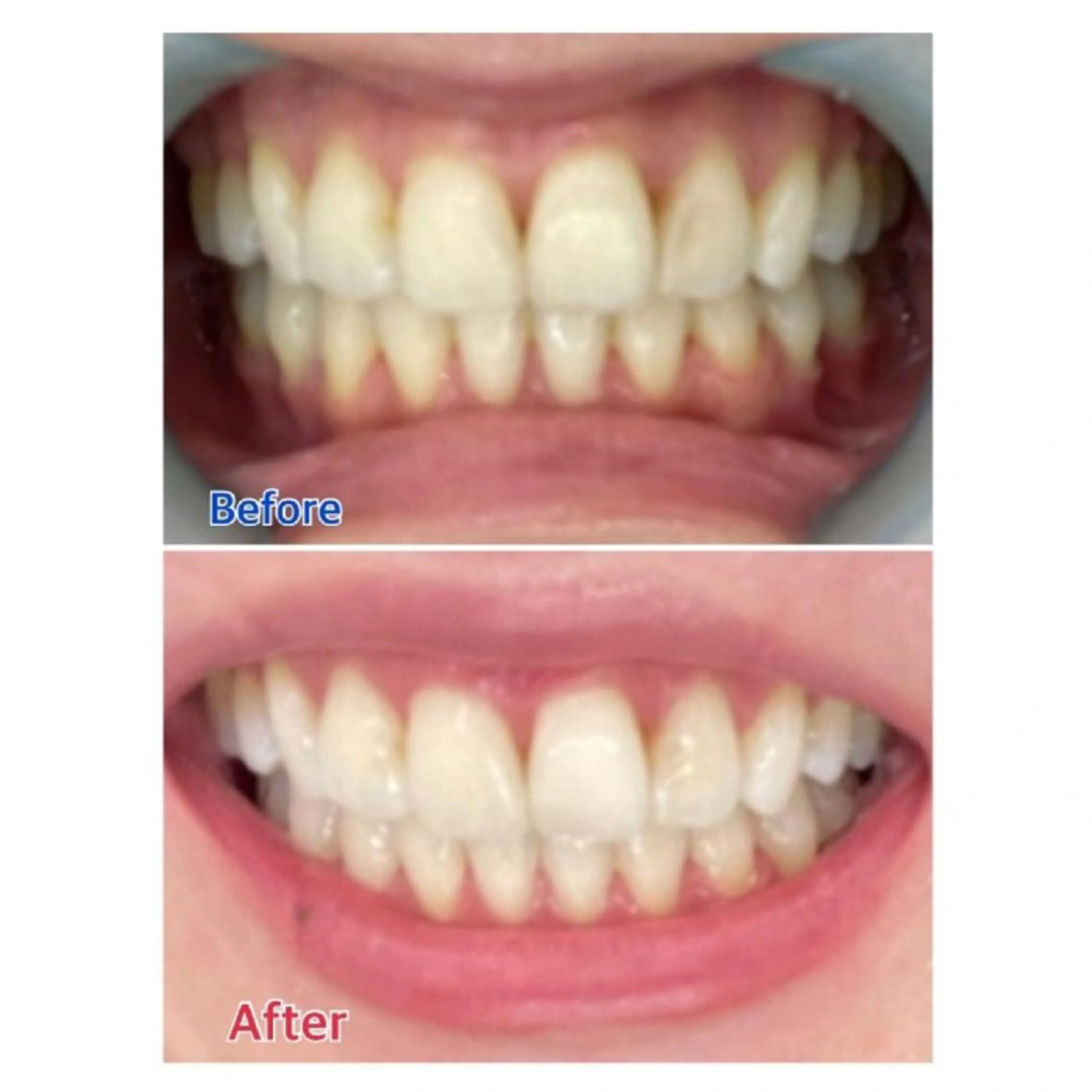 M渋谷店所属・Ｍ渋谷 ホワイトニングのエステ・リラクイメージ