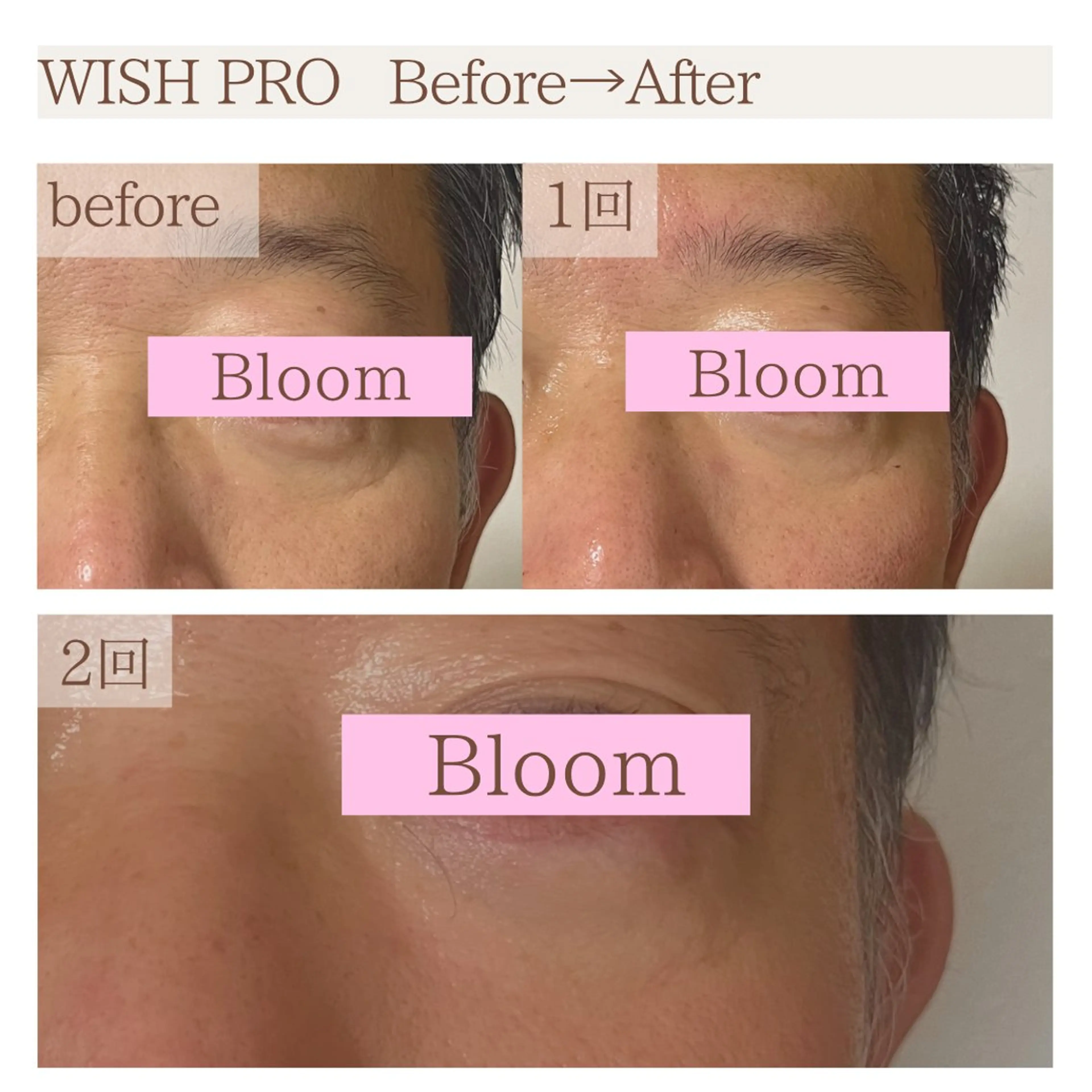 Total Beauty salon Bloom所属・肌育WISHpro 専門サロンBloomのエステ・リラクイメージ