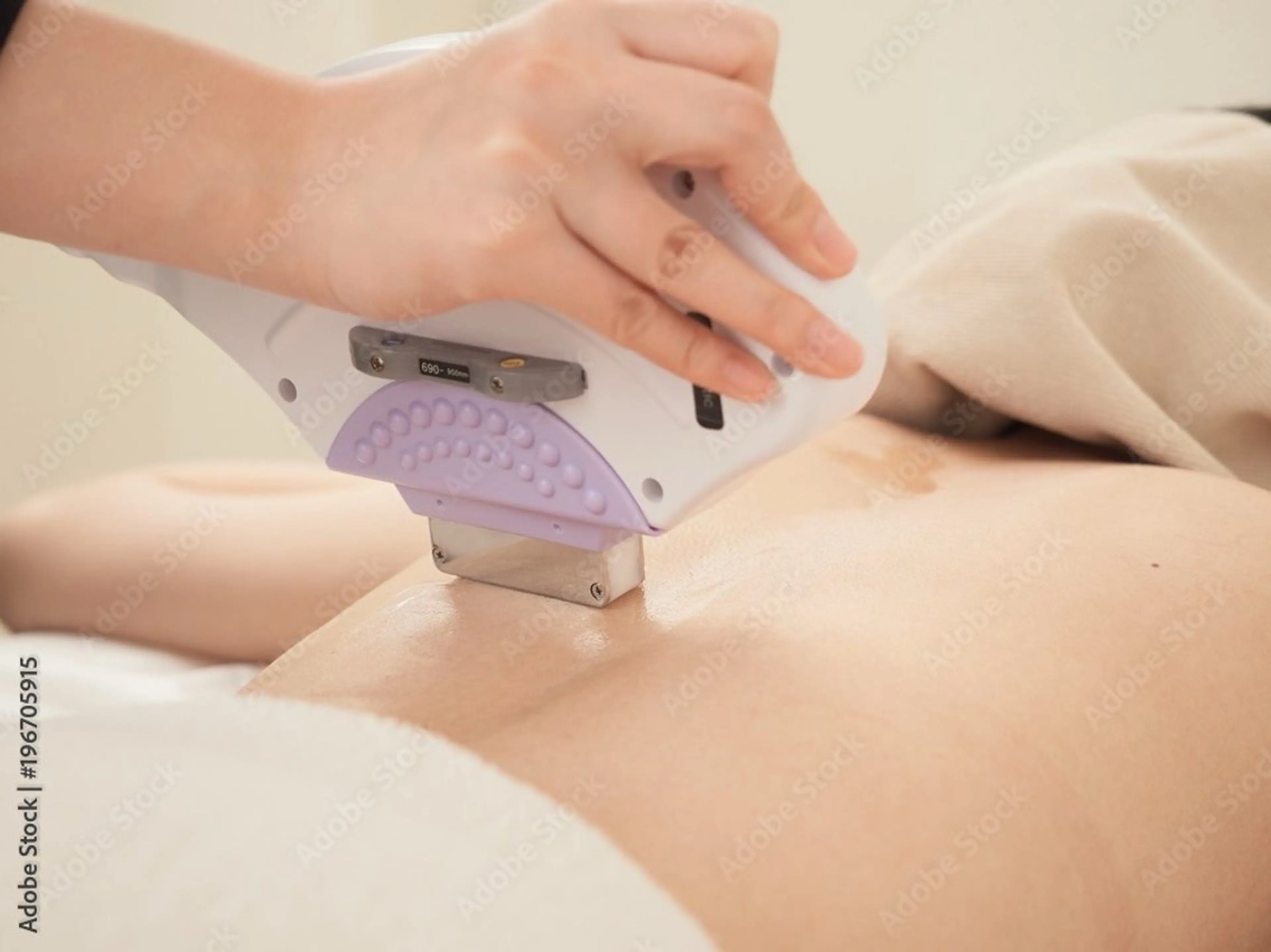 〈女性限定🪽🐰〉全身脱毛(顔・VIO込み)の写真