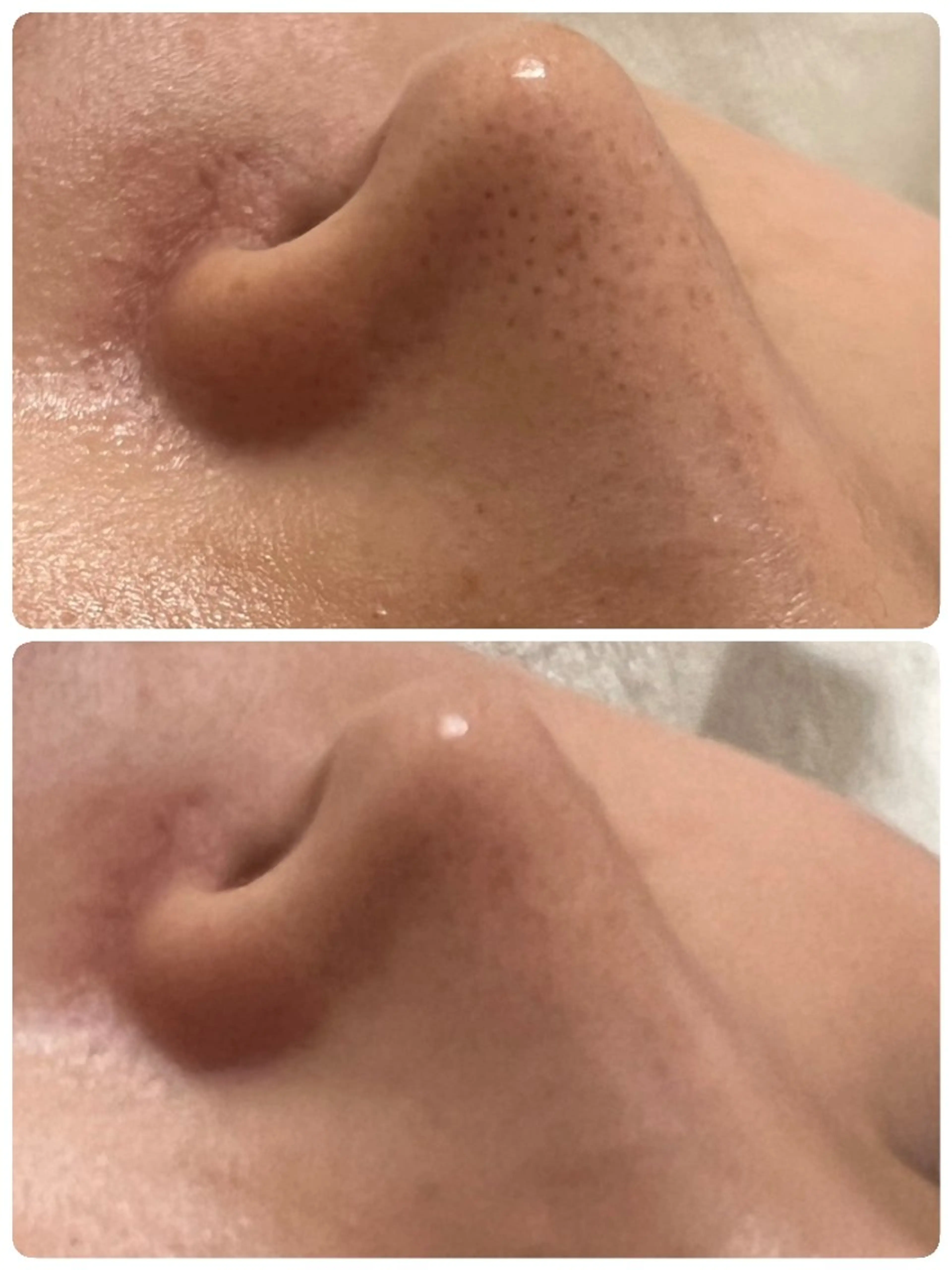 エステ Abe Yukaのエステ・リラクイメージ