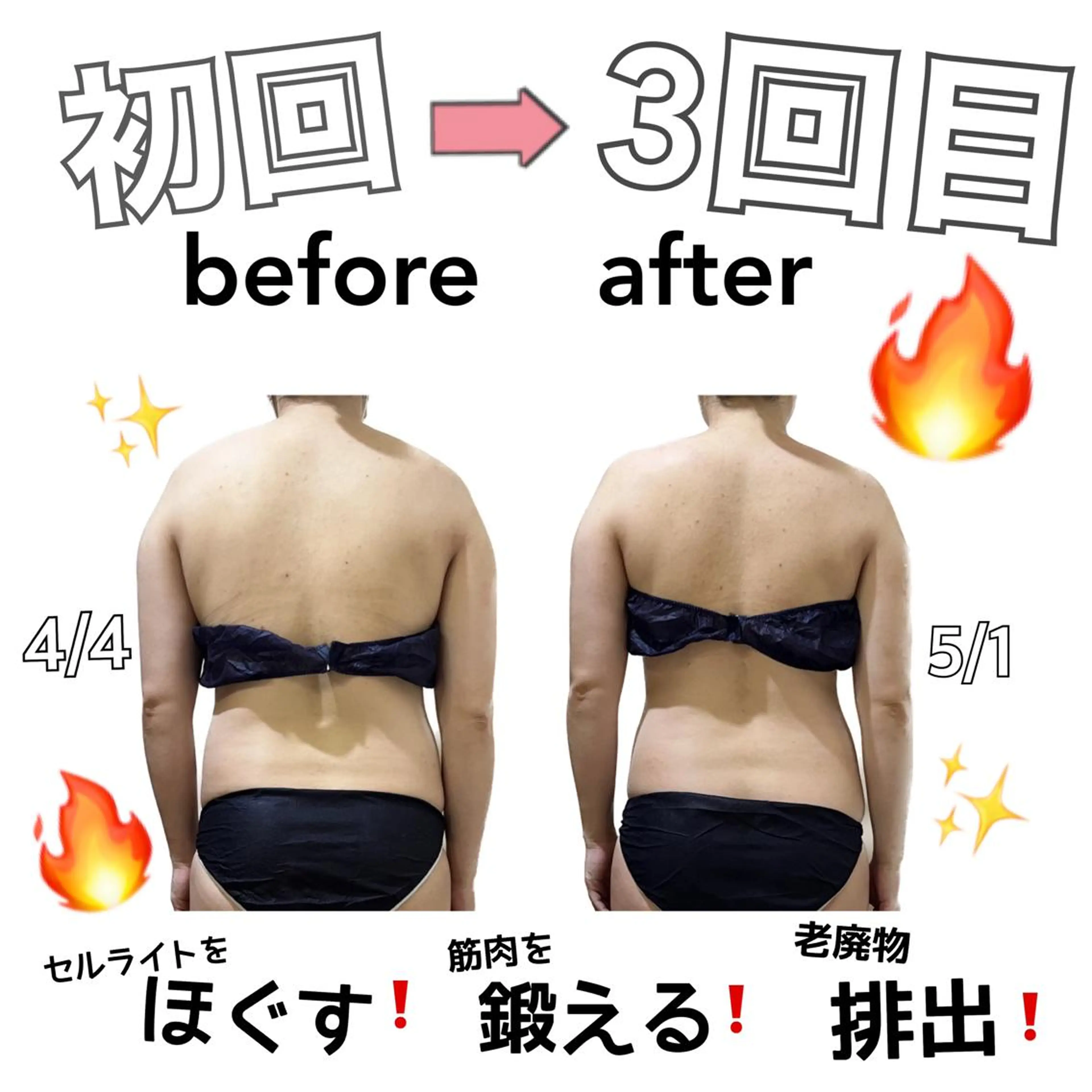 人気No. 1上半身痩せ60分！☀️気になる二の腕も強力マシンでスッキリ！肩こりお腹周りにも◎の写真