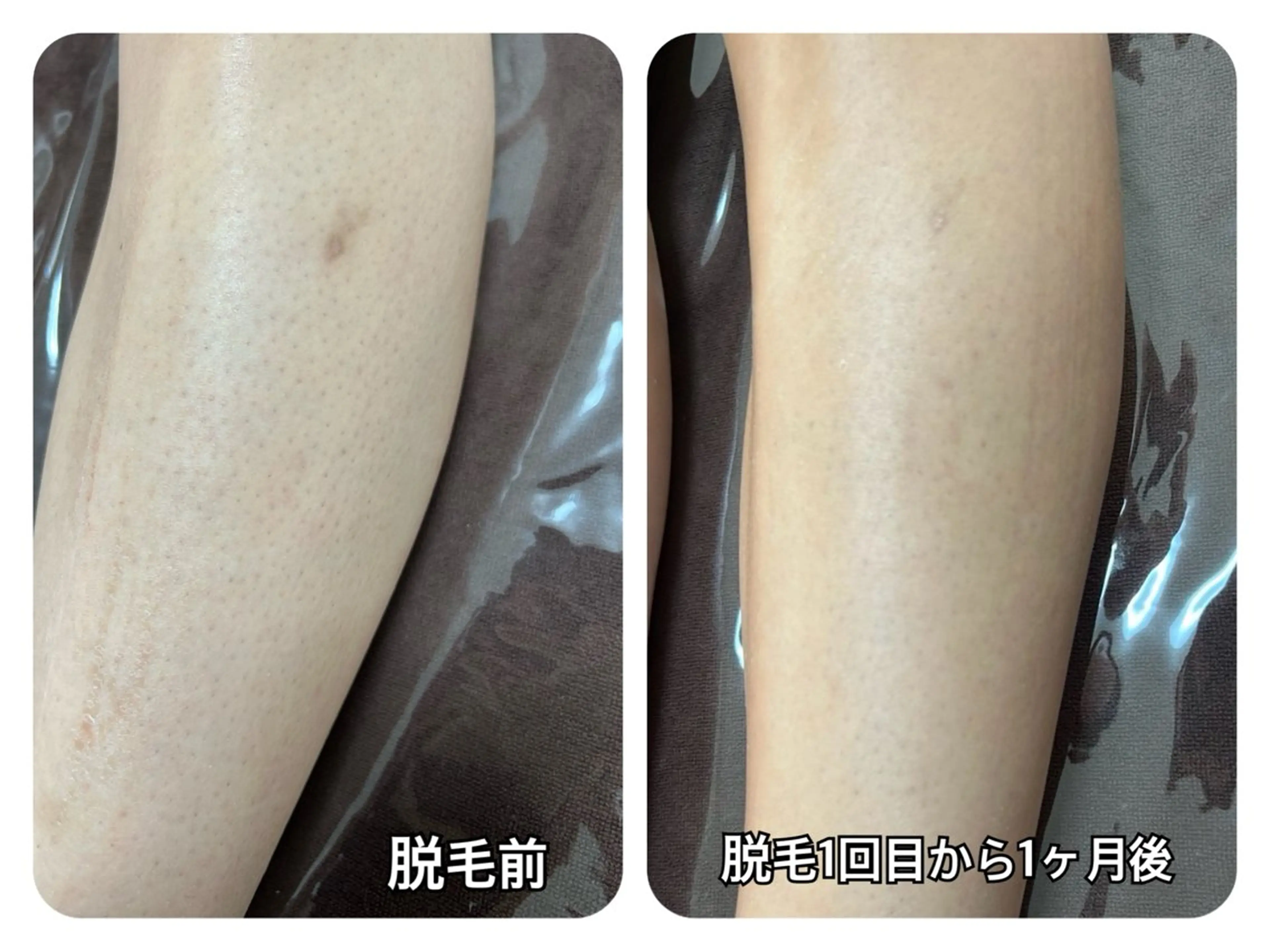 ÉMIA ✴︎のエステ・リラクイメージ