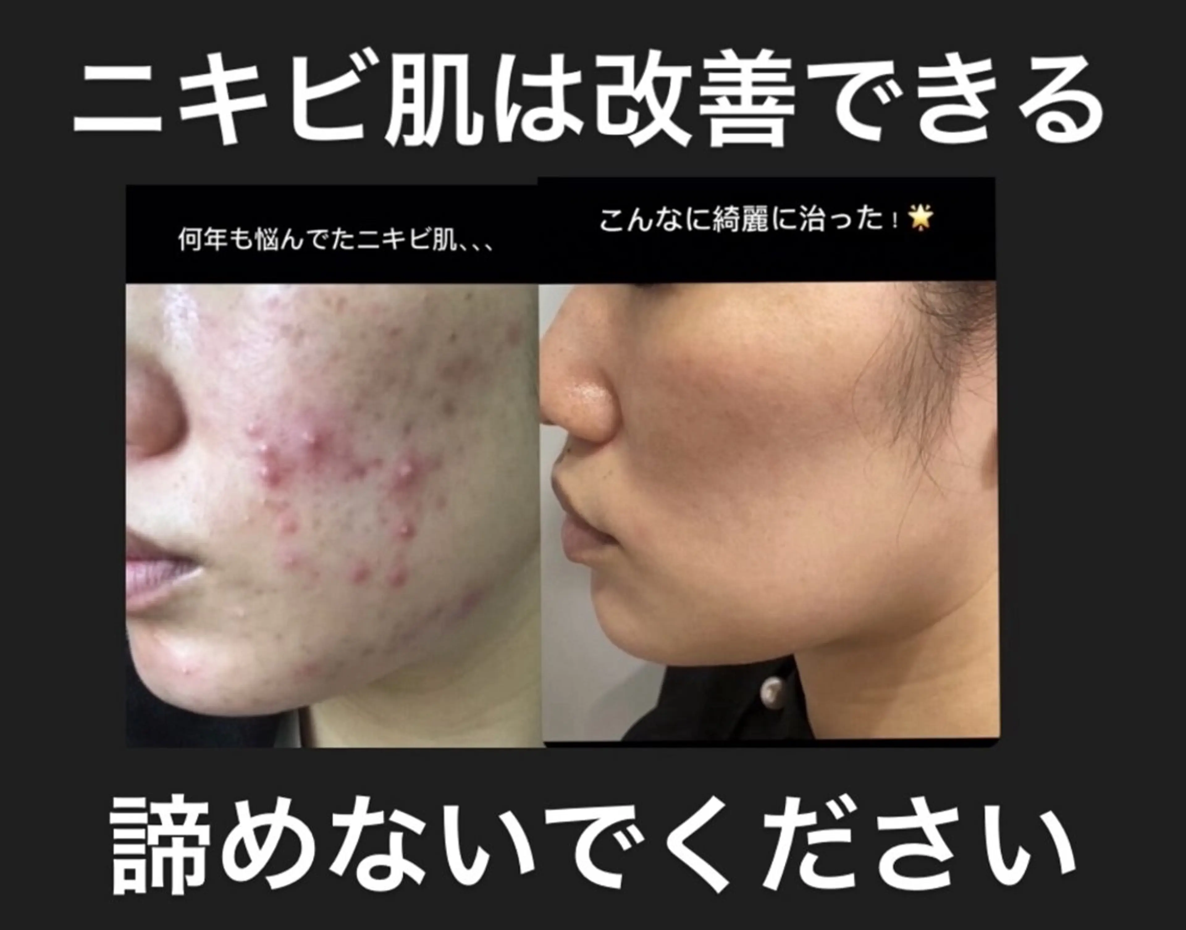 withサロン所属・withサロン/パリ 2600円サロンのマツエク・マツパデザイン