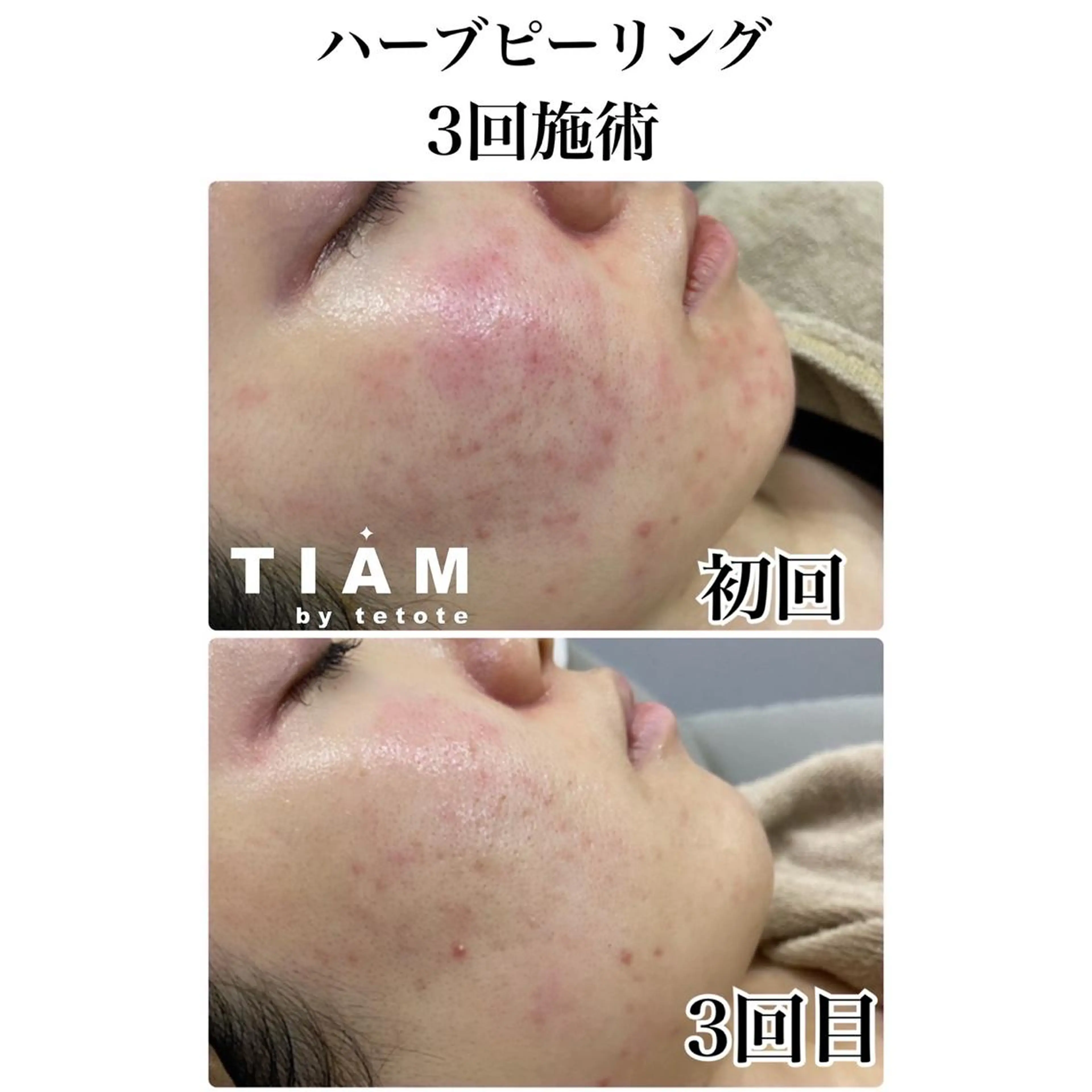 エステ 美肌サロンTIAM by tetoteのエステ・リラクイメージ