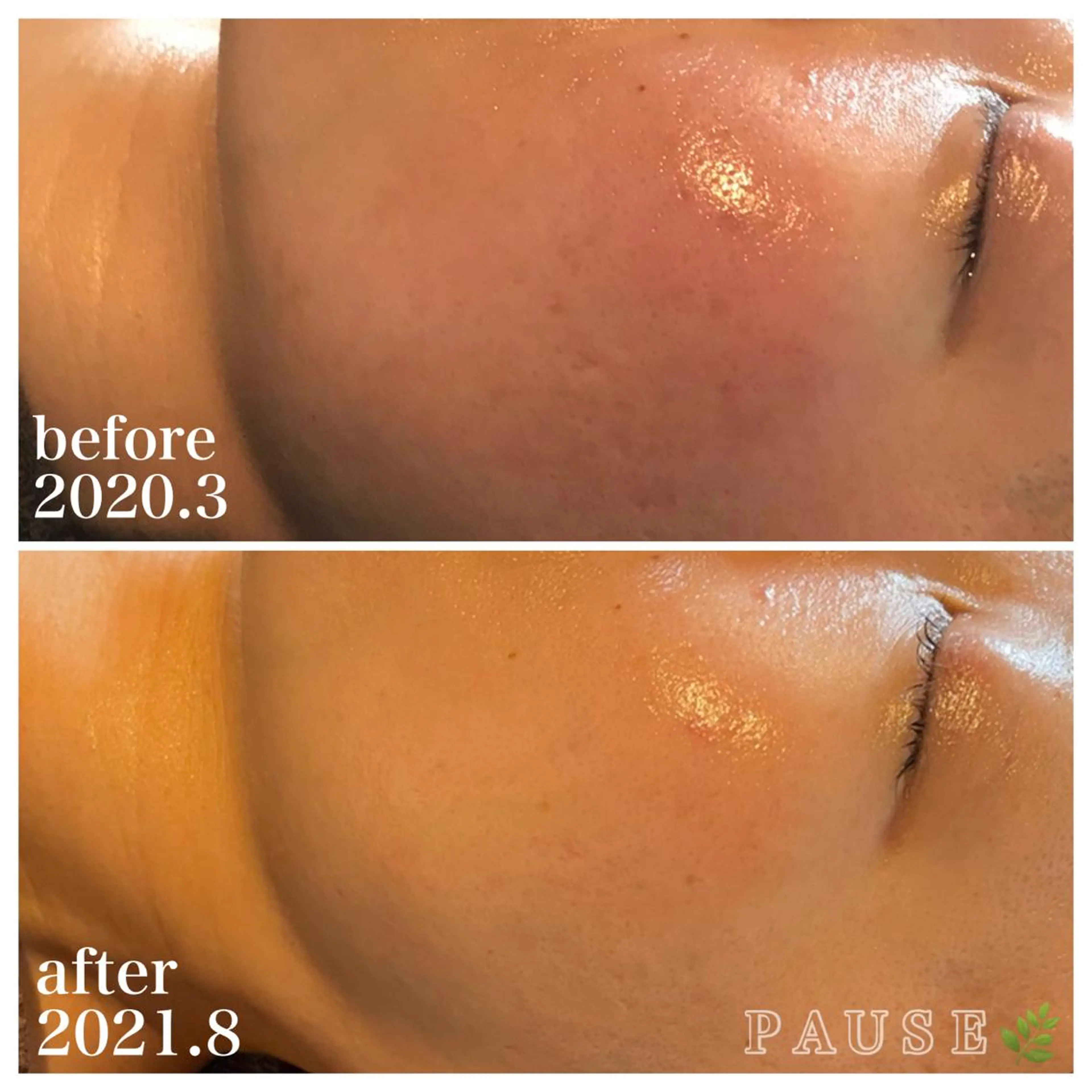 エステ リラク 浜野 恵美のエステ・リラクイメージ