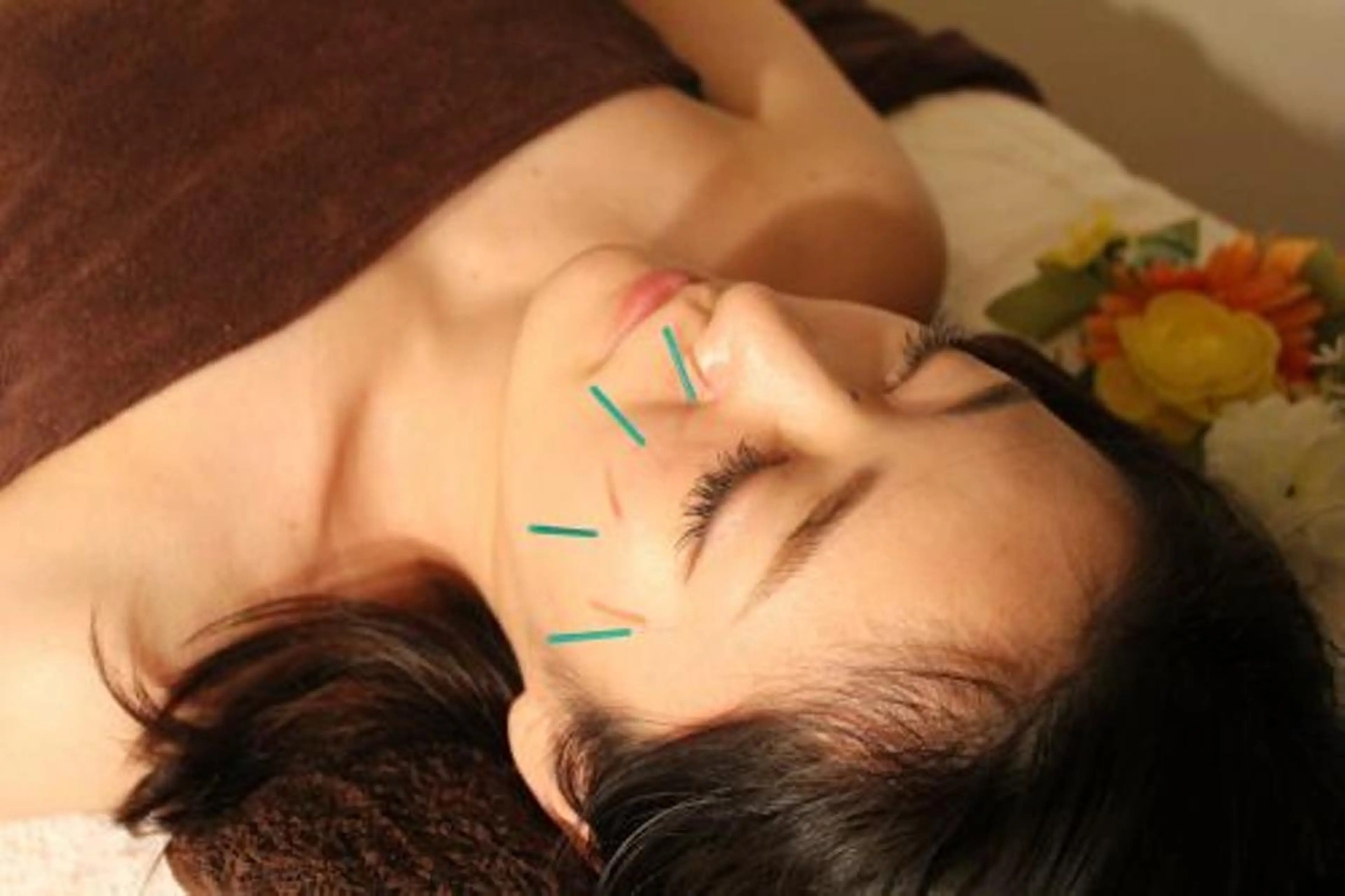 小顔矯正・美容鍼 美鍼堂のエステ・リラクイメージ