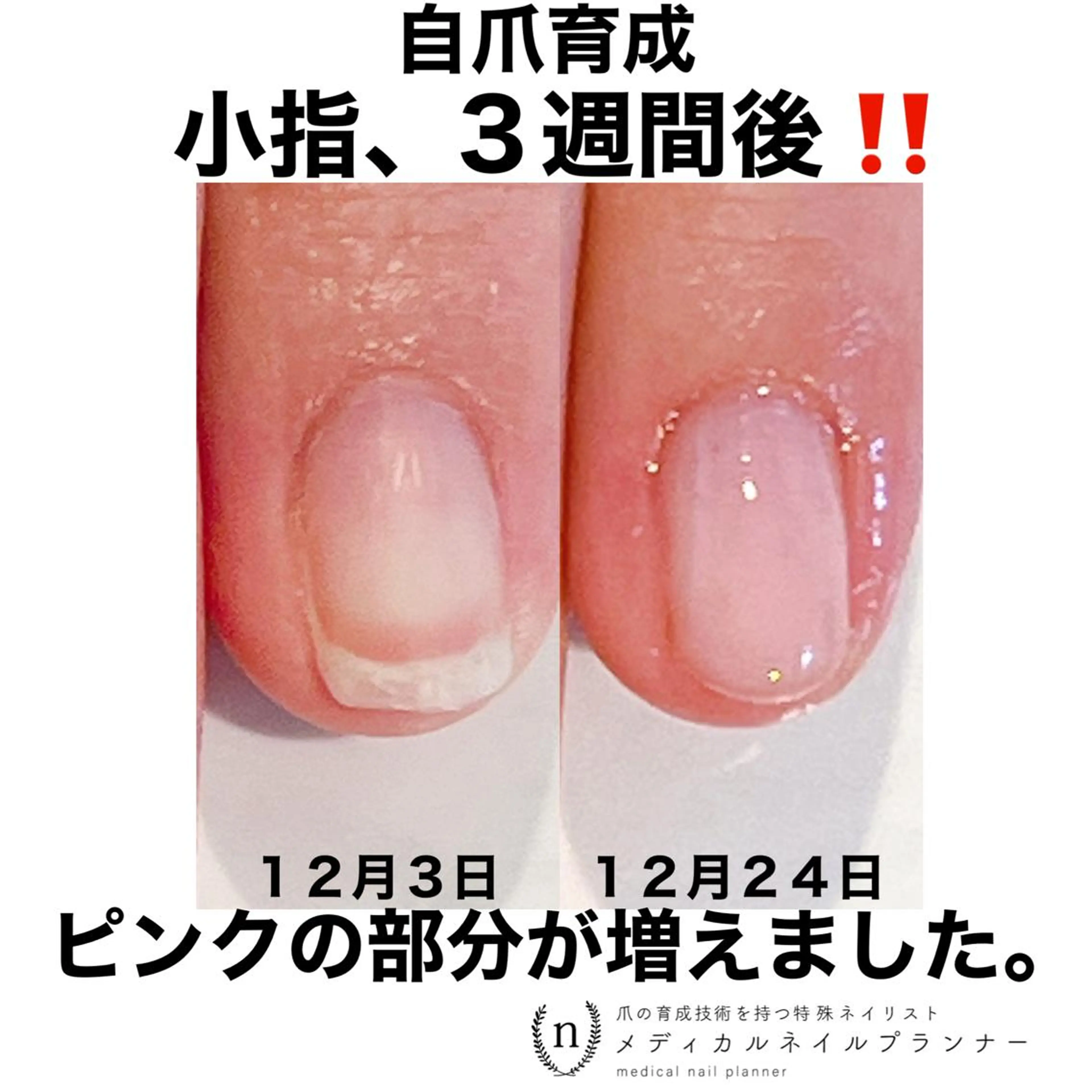 ネイル NAIL SALON ｔｏｇｇｙのネイルデザイン