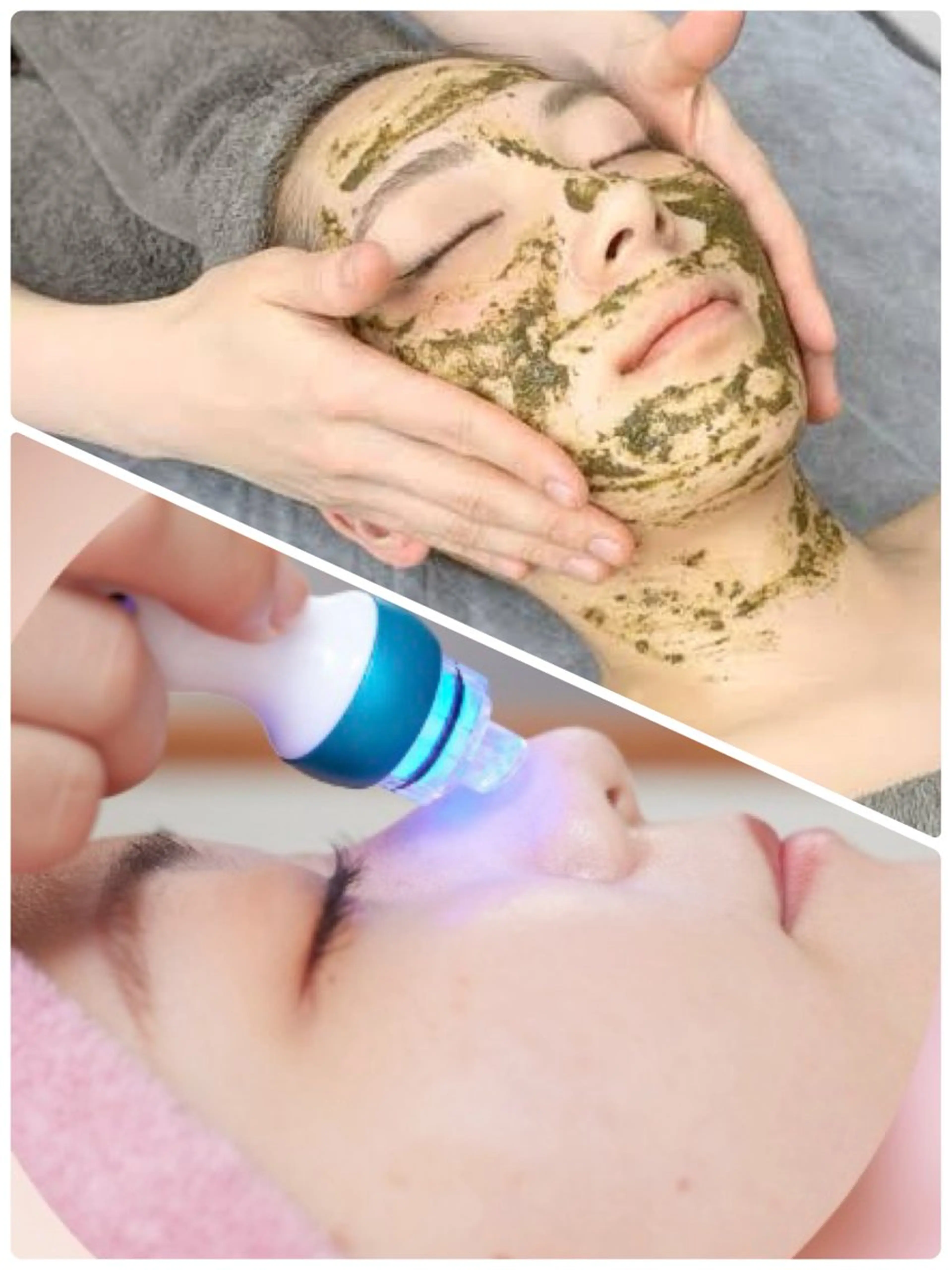 【期間限定✨】ハイドラ＆ハーブピーリングWコース（約60分）※詳細をご確認下さいの写真