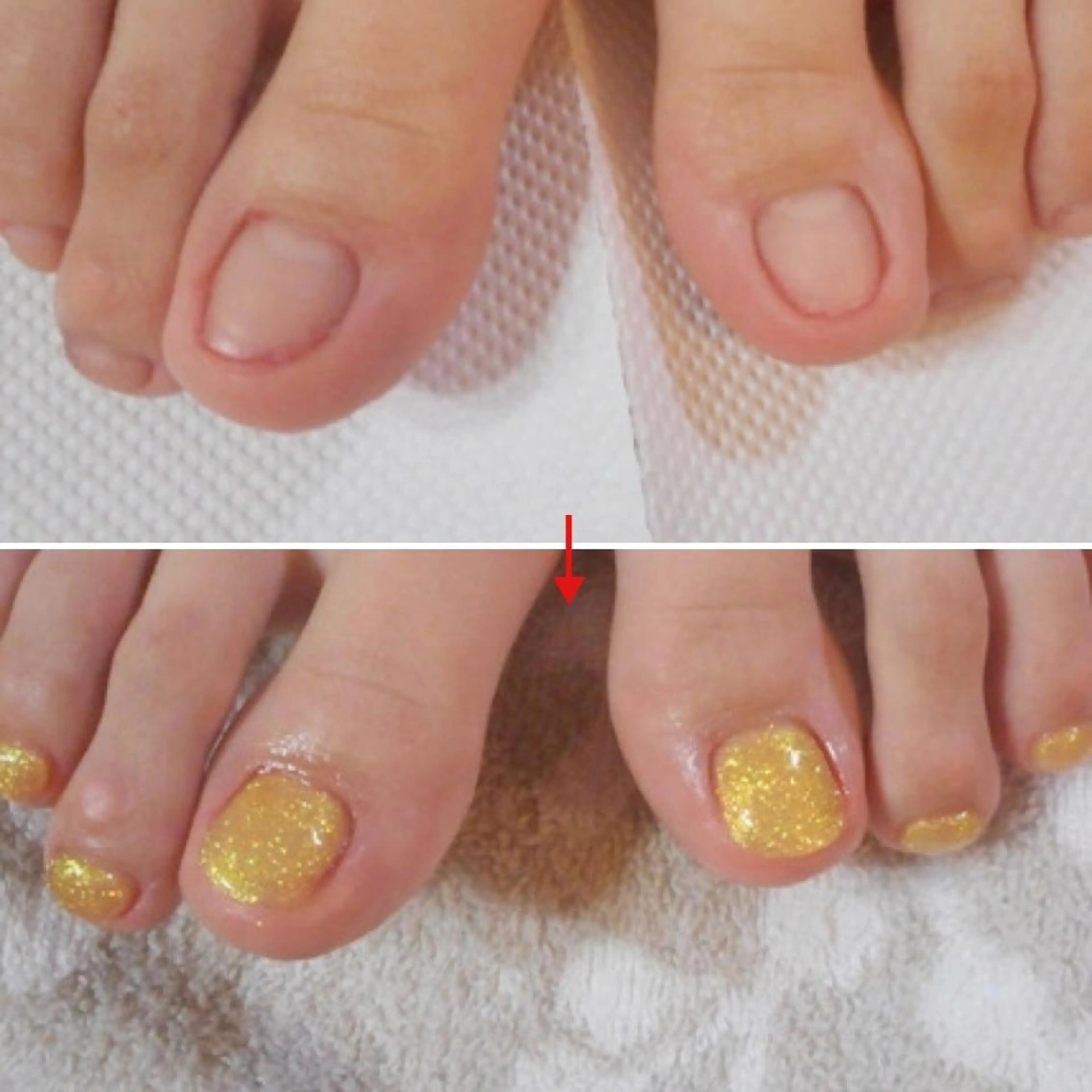 ネイル フットネイル ネイルサロンアリューム所属・ネイルサロン アリュームのネイルデザイン